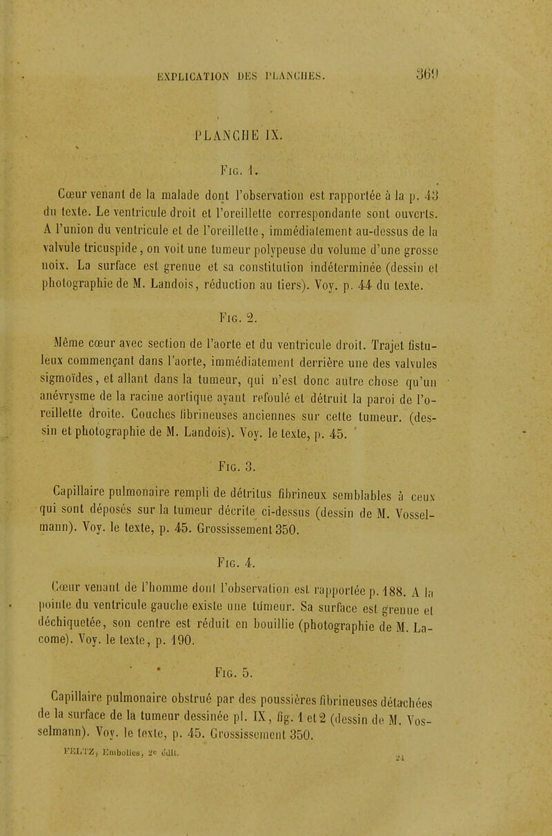 PLANCHE IX. FiG. i. Cœur venant de la malade dont l'observation est rapportée à la p. 43 du texte. Le ventricule droit et l'oreilletle correspondante sont ouverts. A l'union du ventricule et de l'oreilletle, immédiatement au-dessus de la valvule tricuspide, on voit une tumeur polypeuse du volume d'une grosse noix. La surlace est grenue et sa constitution indéterminée (dessin et photographie de M. Landois, réduction au tiers). Voy. p. U du texte. FiG. 2. Même cœur avec section de l'aorte et du ventricule droit. Trajet fistu- leux commençant dans l'aorte, immédiatement derrière une des valvules sigmoïdes, et allant dans la tumeur, qui n'est donc autre chose qu'un anévrysrae de la racine aorlique ayant refoulé et détruit la paroi de l'o- reillette droite. Couches (ibrineuses anciennes sur cette tumeur, (des- sin et photographie de M. Landois). Voy. le texte, p. 45. ' FiG. 3. Capillaire pulmonaire rempli de détritus fibrineux semblables à ceux qui sont déposés sur la tumeur décrite ci-dessus (dessin de M. Vossel- mann). Voy. le texte, p. 45. Grossissement 350. FiG. 4. Cœur venant de l'homme doiil l'observation est rapportée p. 188. A la pointe du ventricule gauche existe une tumeur. Sa surface est grenue et déchiquetée, son centre est réduit en bouillie (photographie de M. La- come). Voy. le texte, p. 190. ■ • FiG. 5. Capillaire pulmonaire obstrué par des poussières fibrineuses détachées de la surface de la tumeur dessinée pl. IX, fig. 1 et 2 (dessin de M. Vos- selmann). Voy. le texte, p. 45. Grossissement 350. FELTZ, Kmbolies, a<; cdll.