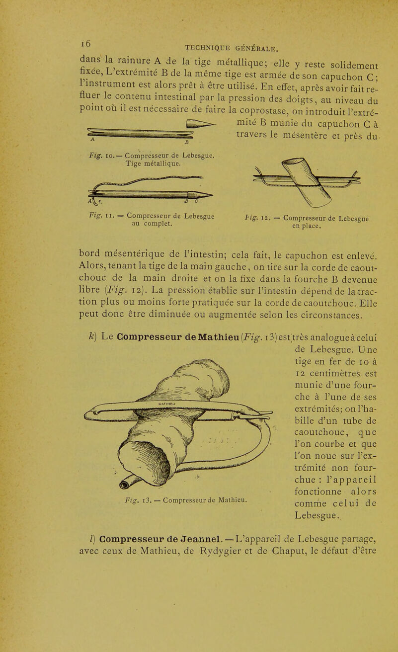 dans la rainure A de la tige métallique; elle y reste solidement faxee, L extrémité B de la môme tige est armée de son capuchon C ■ 1 instrument est alors prêt à être utilisé. En effet, après avoir fait re- fluer le contenu intestinal par la pression des doigts, au niveau du point où il est nécessaire de faire la coprostase, on introduit l'extré- mité B munie du capuchon C à travers le mésentère et près du- Fig. 10.— Compresseur de Lebesgue. Tige métallique. Fig. ii. — Compresseur de Lebesgue au complet. Hg. 12. — Compresseur de Lebesgue en place. bord mésentérique de l'intestin; cela fait, le capuchon est enlevé. Alors, tenant la tige de la main gauche, on tire sur la corde de caout- chouc de la main droite et on la fixe dans la fourche B devenue libre {Fig. 12). La pression établie sur l'intestin dépend de la trac- tion plus ou moins forte pratiquée sur la corde de caoutchouc. Elle peut donc être diminuée ou augmentée selon les circonstances. k) Le Compresseur de Mathieu [Fig. 13) esttrès analogue à celui de Lebesgue. Une tige en fer de 10 à 12 centimètres est munie d'une four- che à l'une de ses extrémités; on l'ha- bille d'un tube de caoutchouc, que l'on courbe et que Ton noue sur l'ex- trémité non four- chue : l'appareil fonctionne alors Fig. 13.-Compresseurde Mathieu. comme celui de Lebesgue. /) Compresseur de Jeannel.—L'appareil de Lebesgue partage, avec ceux de Mathieu, de Rydygier et de Chaput, le défaut d'être