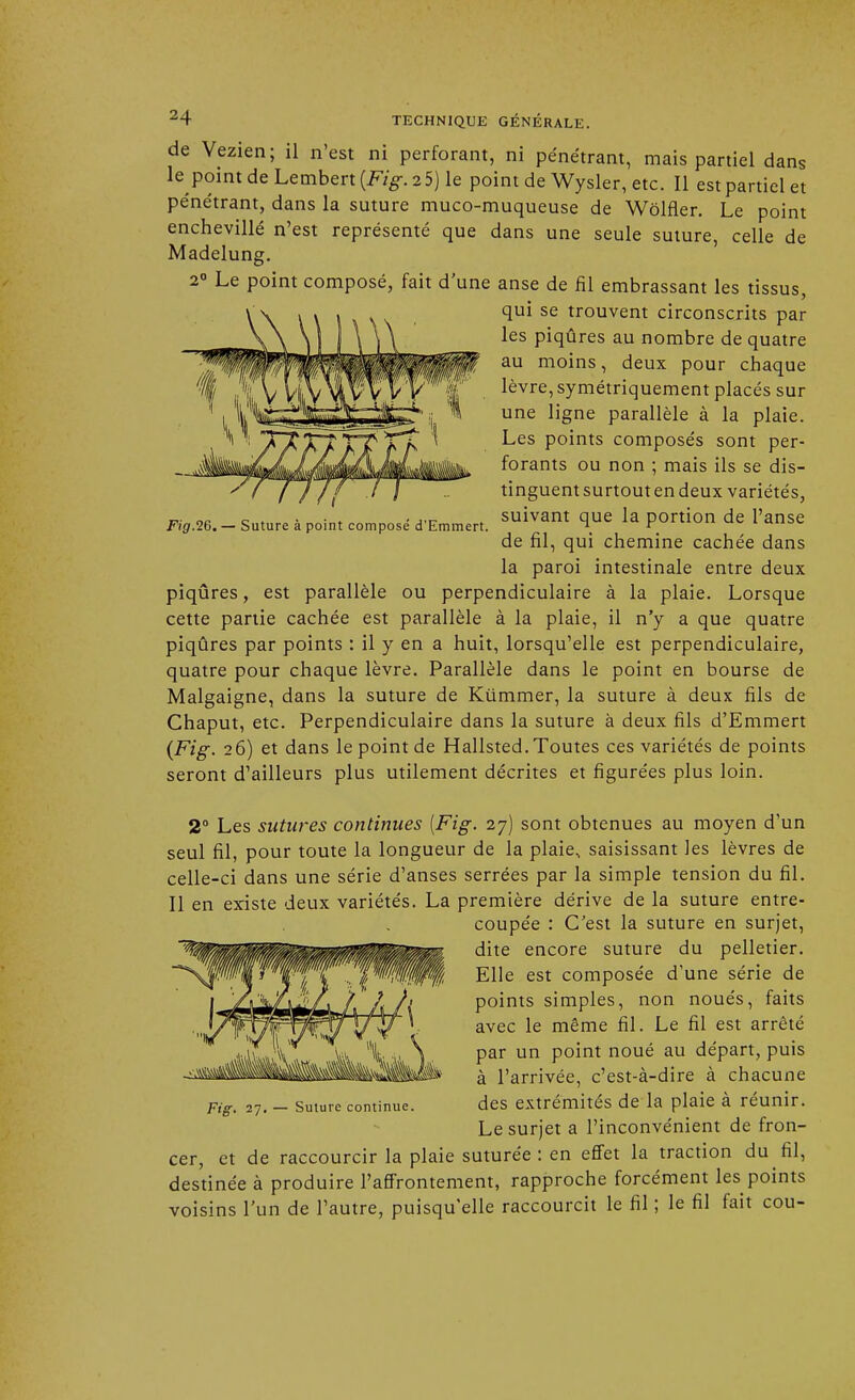 Fig.26. — Suture à point composé d'Emmert. de Vezien; il n'est ni perforant, ni pénétrant, mais partiel dans le point de Lembert {Fig.25) le point de Wysler, etc. Il est partiel et pénétrant, dans la suture muco-muqueuse de Wôlfler. Le point enchevillé n'est représenté que dans une seule suture, celle de Madelung. 2° Le point composé, fait d'une anse de fil embrassant les tissus, qui se trouvent circonscrits par les piqûres au nombre de quatre au moins, deux pour chaque lèvre, symétriquement placés sur une ligne parallèle à la plaie. Les points composés sont per- forants ou non ; mais ils se dis- tinguent surtout en deux variétés, suivant que la portion de l'anse de fil, qui chemine cachée dans la paroi intestinale entre deux piqûres, est parallèle ou perpendiculaire à la plaie. Lorsque cette partie cachée est parallèle à la plaie, il n'y a que quatre piqûres par points : il y en a huit, lorsqu'elle est perpendiculaire, quatre pour chaque lèvre. Parallèle dans le point en bourse de Malgaigne, dans la suture de Kummer, la suture à deux fils de Chaput, etc. Perpendiculaire dans la suture à deux fils d'Emmert (Fig. 26) et dans le point de Hallsted.Toutes ces variétés de points seront d'ailleurs plus utilement décrites et figurées plus loin. 2° Les sutures continues [Fig. 27) sont obtenues au moyen d'un seul fil, pour toute la longueur de la plaie, saisissant les lèvres de celle-ci dans une série d'anses serrées par la simple tension du fil. Il en existe deux variétés. La première dérive de la suture entre- coupée : C'est la suture en surjet, dite encore suture du pelletier. Elle est composée d'une série de points simples, non noués, faits avec le même fil. Le fil est arrêté par un point noué au départ, puis à l'arrivée, c'est-à-dire à chacune des extrémités de la plaie à réunir. Le surjet a l'inconvénient de fron- cer, et de raccourcir la plaie suturée : en effet la traction du fil, destinée à produire l'affrontement, rapproche forcément les points voisins l'un de l'autre, puisqu'elle raccourcit le fil ; le fil fait cou- Fig. 27. — Suture continue.