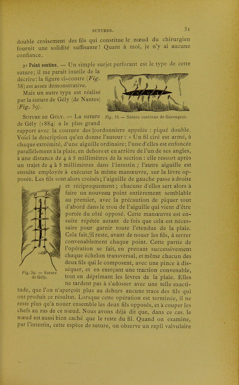 double croisement des fils qui constitue le nœud du chirurgien fournit une solidité suffisante! Quant à moi, je n'y ai aucune confiance. 2» Point continu. — Un simple surjet perforant est le type de cette suture; il me paraît inutile de la décrire: la figure ci-contre {Fig. 38) est assez démonstrative. Mais un autre type est réalisé par la suture de Gély (de Nantes) (Fig. 39). SUTURE DE GÉLY. — La suture Fig. 38.— Suture continue de Garengeot. de Gély (1884) a le plus grand rapport avec la couture des [cordonniers appelée : piqué double. Voici la description qu'en donne l'auteur : « Un fil ciré est armé, à chaque extrémité, d'une aiguille ordinaire; l'une d'elles est enfoncée parallèlement à la plaie, en dehors et en arrière de l'un de ses angles, à une distance de 4 à 5 millimètres de la section : elle ressort après un trajet de 4 à 5 millimètres dans l'intestin ; l'autre aiguille est ensuite employée à exécuter la même manœuvre, sur la lèvre op- posée. Les fils sont alors croisés; l'aiguille de gauche passe adroite et réciproquement ; chacune d'elles sert alors à faire un nouveau point entièrement semblable au premier, avec la précaution de piquer tout d'abord dans le trou de l'aiguille qui vient d'être portée du côté opposé. Cette manœuvre est en- suite répétée autant de fois que cela est néces- saire pour garnir toute l'étendue de la plaie. Cela fait,f,il reste, avant de nouer les fils, à serrer convenablement chaque point. Cette partie de l'opération se fait, en prenant successivement chaque échelon transversal, et même chacun des deux fils qui le composent, avec une pince à dis- séquer, et en exerçant une traction convenable, tout en déprimant les lèvres de la plaie. Elles ne tardent pas à s'adosser avec une telle exacti- tude, que l'on n'aperçoit plus au dehors aucune trace des fils qui ont produit ce résultat. Lorsque cette opération est terminée, il ne reste plus qu'à nouer ensemble les deux fils opposés, et à couper les chefs au ras de ce nœud. Nous avons déjà dit que, dans ce cas, le nœud est aussi bien caché que le reste du fil. Quand on examine, par l'intestin, cette espèce de suture, on observe un repli valvulaire Fig. 3o. — Suture de Gély.