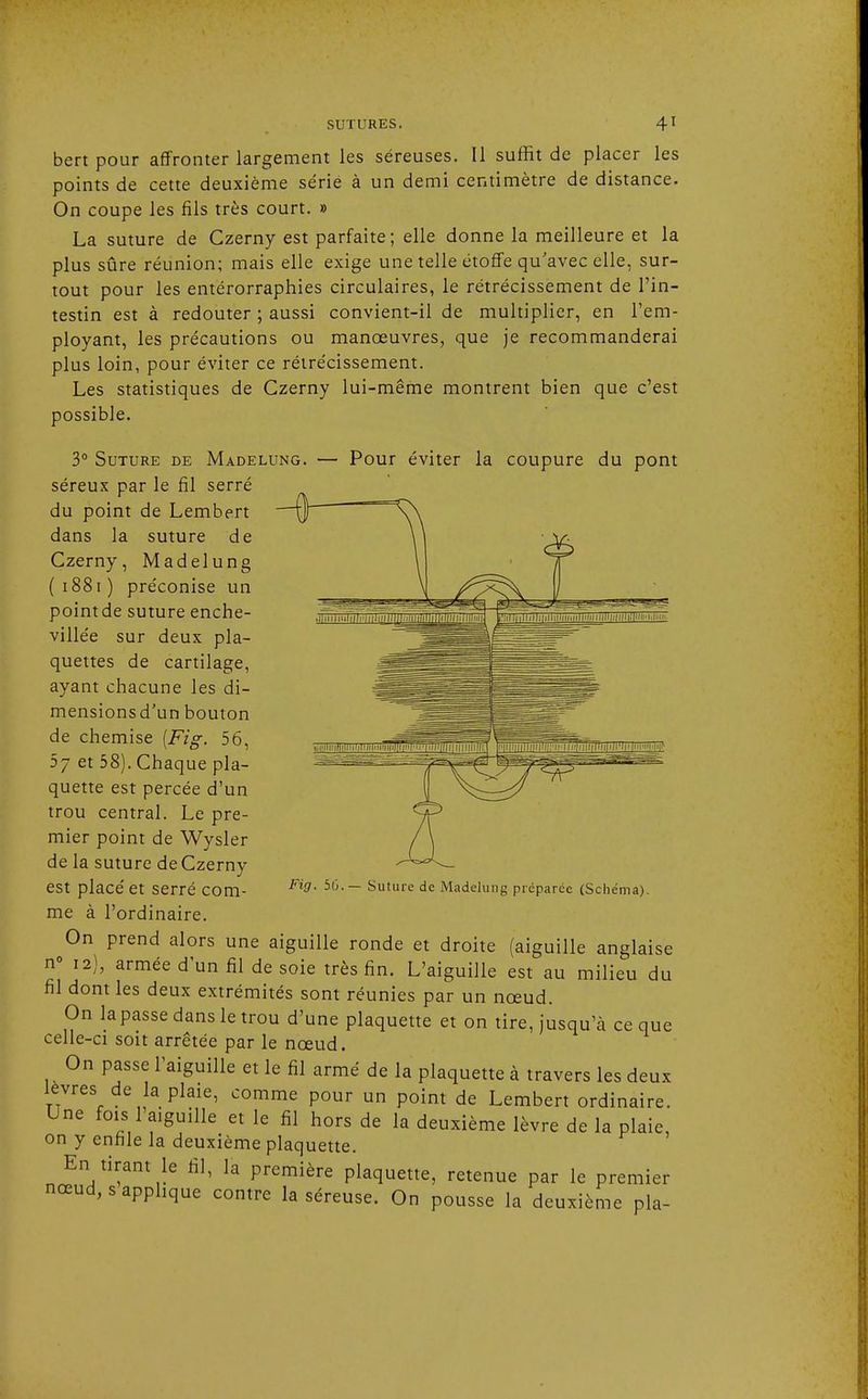 bert pour affronter largement les séreuses. Il suffit de placer les points de cette deuxième série à un demi centimètre de distance. On coupe les fils très court. » La suture de Czerny est parfaite; elle donne la meilleure et la plus sûre réunion; mais elle exige une telle étoffe qu'avec elle, sur- tout pour les entérorraphies circulaires, le rétrécissement de l'in- testin est à redouter ; aussi convient-il de multiplier, en l'em- ployant, les précautions ou manœuvres, que je recommanderai plus loin, pour éviter ce rétrécissement. Les statistiques de Czerny lui-même montrent bien que c'est possible. 3° Suture de Madelung. — Pour éviter la coupure du pont séreux par le fil serré du point de Lembert —O- dans la suture de Czerny, Madelung ( 1881 ) préconise un pointde suture enche- villée sur deux pla- quettes de cartilage, ayant chacune les di- mensions d'un bouton de chemise {Fig. 56 5j et 58). Chaque pla- quette est percée d'un trou central. Le pre- mier point de Wysler de la suture de Czerny est placé et serré com- me à l'ordinaire. On prend alors une aiguille ronde et droite (aiguille anglaise n° 12), armée d'un fil de soie très fin. L'aiguille est au milieu du fil dont les deux extrémités sont réunies par un nœud. On la passe dans le trou d'une plaquette et on tire, jusqu'à ce que celle-ci soit arrêtée par le nœud. On passe l'aiguille et le fil armé de la plaquette à travers les deux lèvres de la plaie, comme pour un point de Lembert ordinaire. Une fois l'aiguille et le fil hors de la deuxième lèvre de la plaie, on y enfile la deuxième plaquette. En tirant le fil, la première plaquette, retenue par le premier nœud, s applique contre la séreuse. On pousse la deuxième pla- Fig. 56.— Suture de Madelung préparée (Schéma).