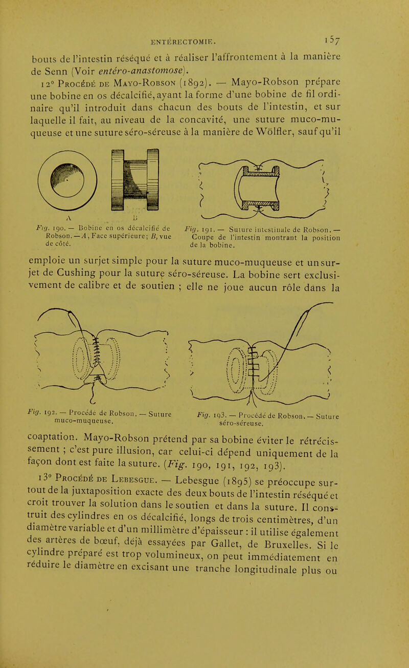bouts de l'intestin réséqué et à réaliser l'affrontement à la manière de Senn (Voir entéro-anastomose). 12° Procédé de Mayo-Robson (1892). — Mayo-Robson prépare une bobine en os décalcifié, ayant la forme d'une bobine de fil ordi- naire qu'il introduit dans chacun des bouts de l'intestin, et sur laquelle il fait, au niveau de la concavité, une suture muco-mu- queuse et une suture séro-séreuse à la manière de Wôlfler, sauf qu'il Fig. igo. — Bobine en os décalcifie' de Robson.—A, Face supérieure; fi, vue de côté. Fig. 191.— Suture intestinale de Robson.— Coupe de l'intestin montrant la position de la bobine. emploie un surjet simple pour la suture muco-muqueuse et un sur- jet de Cushing pour la suture séro-séreuse. La bobine sert exclusi- vement de calibre et de «outien ; elle ne joue aucun rôle dans la Firj. 192. — Procédé de Robson. — Suture muco-muqueuse. Fig. iq'3. — Procédé de Robson. — Suture séro-séreuse. coaptation. Mayo-Robson prétend par sa bobine éviter le rétrécis- sement ; c'est pure illusion, car celui-ci dépend uniquement de la façon dont est faite la suture. (Fig. 190, 191, 192, i93). i3° Procédé de Lebesgue. — Lebesgue (i895) se préoccupe sur- tout de la juxtaposition exacte des deux bouts de l'intestin réséqué et croit trouver la solution dans le soutien et dans la suture. Il cons- truit des cylindres en os décalcifié, longs de trois centimètres, d'un diamètre variable et d'un millimètre d'épaisseur : il utilise également des artères de bœuf, déjà essayées par Gallet, de Bruxelles. Si le cylindre préparé est trop volumineux, on peut immédiatement en réduire le diamètre en excisant une tranche longitudinale plus ou