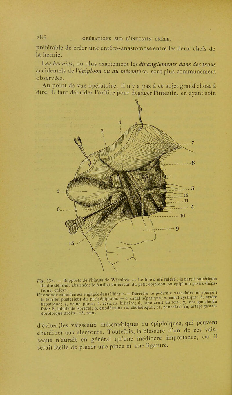préférable de créer une entéro-anastomose entre les deux chefs de la hernie. Les hernies, ou plus exactement les étranglements dans des trous accidentels de Vépiploon ou du mésentère, sont plus communément observées. Au point de vue opératoire, il n'y a pas à ce sujet grand'chose à dire. Il faut débrider l'orifice pour dégager l'intestin, en ayant soin Fig. 33i. — Rapports de l'hiatus de Winslow. — Le foie a été relevé; la partie supérieure du duodénum, abaissée; le feuillet antérieur du petit épiploon ou épiploon gastro-hepa- tique, enlevé. , . Une sonde cannelée est engagée dans l'hiatus.-Derrière le pédicule vasculaire on aperçoit le feuillet postérieur du petit épiploon. - i, canal hépatique; 2, canal cystique; i, artère hépatique; 4, veine porte; 5, vésicule biliaire; 6, lobe droit du foie; 7, lobe gauche du foie; 8, lobule de Spiegel; 9, duodénum; 10, cholédoque; 11, pancréas; 12, artère gastro- épiploïque droite; i3, rein. d'éviter jles vaisseaux mésentériques ou épiploïques, qui peuvent cheminer aux alentours. Toutefois, la blessure d'un de ces vais- seaux n'aurait en général qu'une médiocre importance, car il serait facile de placer une pince et une ligature.
