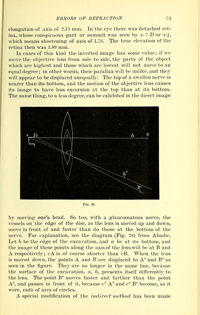elong-ation of axis of 2.13 mm. In the there was detached ret- ina, whose conspicuous part or summit was seen by + 7 D or +|^, which means shortening- of axis of 1.76. The true elevation of the retina then was 3.89 mm. In cases of this kind the inverted imag-e has some value; if we move the objective lens from side to side, the parts of the object which are hig-hest and those which are lowest will not move to an equaldeg-ree; in other words, their parallax will be unlike, and they will appear to be displaced unequally. Tlie top of a swollen nerve is nearer than its bottom, and the motion of the objective lens causes its image to have less excursion at the top than at its bottom. The same thing, to a less degree, can be exhibited in the direct image Fig. 28. by moving one's head. So too, with a glaucomatous nerve, the vessels on the edge of the disc, as the lens is moved up and down, move in front of and faster than do those at the bottom of the nerve. For explanation, see the diagram (Fig. 28) from Abadie. Let h be the edge of the excavation, and a be at its bottom, and the image of these points along the axis of the lens will be at B and A respectively; cA is of course shorter than cB. When the lens is moved down, the points A and B are displaced to A' and B' as seen in the figure. Thej^ are no longer in the same line, because the surface of the excavation, a, b, presents itself differently to the lens. The point B' moves faster and farther than the pomt A', and passes in front of it, because c' A' and c' B' become, as it were, radii of arcs of circles. A special modification of the indirect method has been made