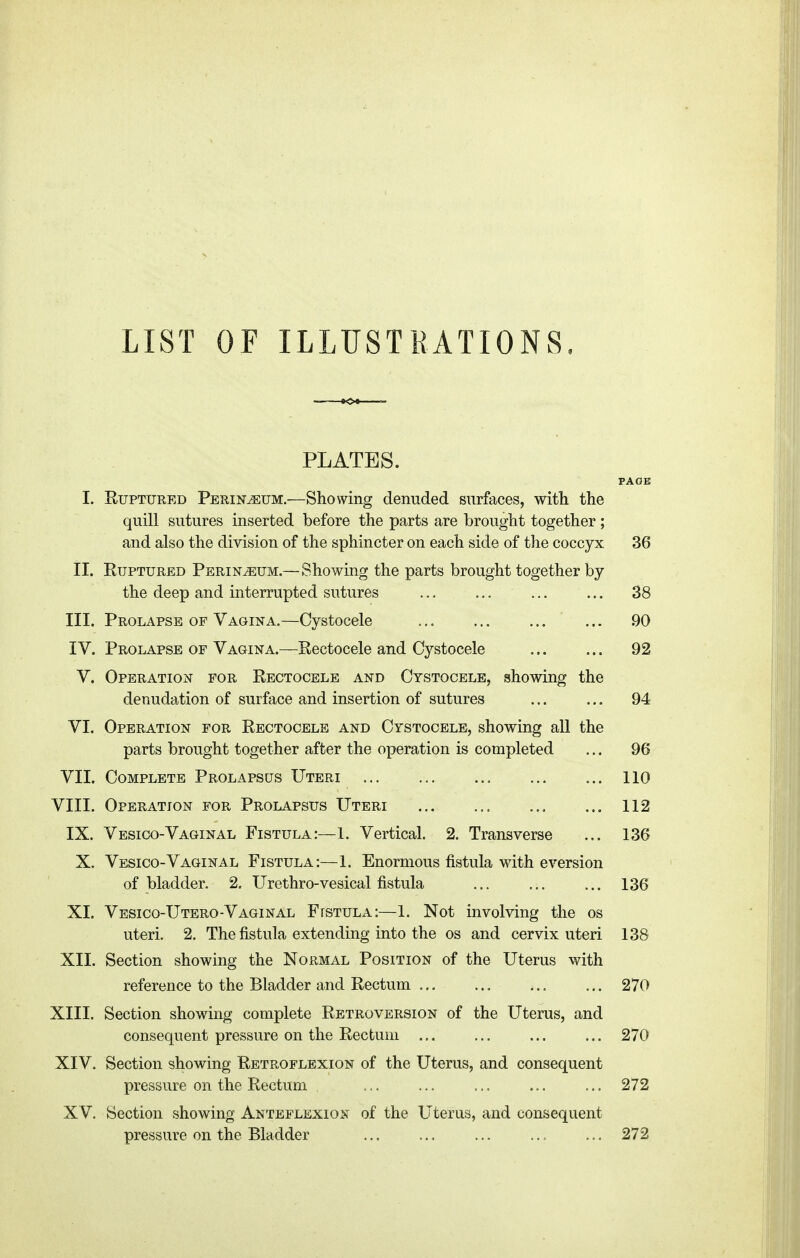 LIST OF ILLUSTRATIONS. PLATES. PAGE I. Ruptured Perineum.—Showing denuded surfaces, with the quill sutures inserted before the parts are brought together; and also the division of the sphincter on each side of the coccyx 36 II. Ruptured Perineum.—Showing the parts brought together by the deep and interrupted sutures 38 III. Prolapse of Vagina.—Cystocele 90 IV. Prolapse of Vagina.—Rectocele and Cystocele 92 V. Operation for Rectocele and Cystocele, showing the denudation of surface and insertion of sutures ... ... 94 VI. Operation for Rectocele and Cystocele, showing all the parts brought together after the operation is completed ... 96 VII. Complete Prolapsus Uteri 110 VIII. Operation for Prolapsus Uteri ... ... ... ... 112 IX. Vesico-Vaginal Fistula:—1. Vertical. 2. Transverse ... 136 X. Vesico-Vaginal Fistula:—1. Enormous fistula with eversion of bladder. 2. Urethro-vesical fistula ... ... ... 136 XI. Vesico-Utero-Vaginal Ftstula:—1. Not involving the os uteri. 2. The fistula extending into the os and cervix uteri 138 XII. Section showing the Normal Position of the Uterus with reference to the Bladder and Rectum 270 XIII. Section showing complete Retroversion of the Uterus, and consequent pressure on the Rectum ... ... ... ... 270 XIV. Section showing Retroflexion of the Uterus, and consequent pressure on the Rectum . 272 XV. Section showing Anteflexion of the Uterus, and consequent pressure on the Bladder 272