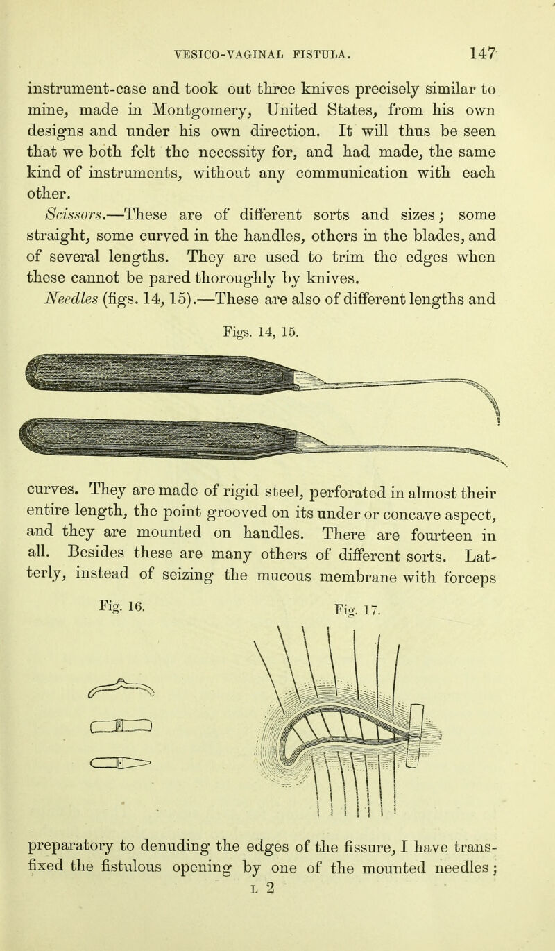 instrument-case and took out three knives precisely similar to mine, made in Montgomery, United States, from Lis own designs and under his own direction. It will thus be seen that we both felt the necessity for, and had made, the same kind of instruments, without any communication with each other. Scissors.—These are of different sorts and sizes; some straight, some curved in the handles, others in the blades, and of several lengths. They are used to trim the edges when these cannot be pared thoroughly by knives. Needles (figs. 14,15).—These are also of different lengths and Figs. 14, 15. curves. They are made of rigid steel, perforated in almost their entire length, the point grooved on its under or concave aspect, and they are mounted on handles. There are fourteen in all. Besides these are many others of different sorts. Lat- terly, instead of seizing the mucous membrane with forceps Fig. 16. Fig. 17< preparatory to denuding the edges of the fissure, I have trans- fixed the fistulous opening by one of the mounted needles; l 2