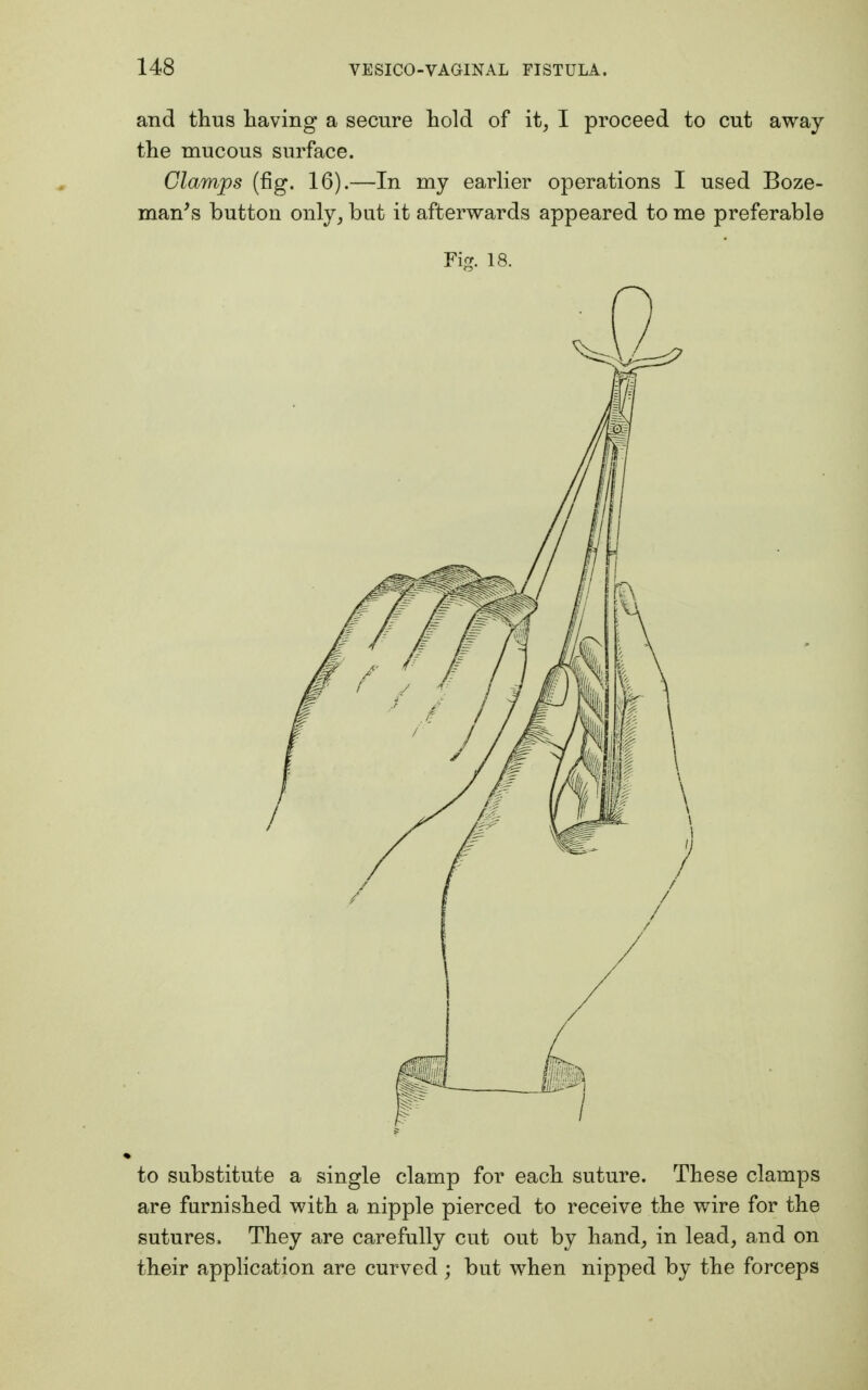 and thus having a secure hold of it, I proceed to cut away the mucous surface. Clamps (fig. 16).—In my earlier operations I used Boze- man's button only, but it afterwards appeared to me preferable Fig. 18. to substitute a single clamp for each suture. These clamps are furnished with a nipple pierced to receive the wire for the sutures. They are carefully cut out by hand, in lead, and on their application are curved ; but when nipped by the forceps