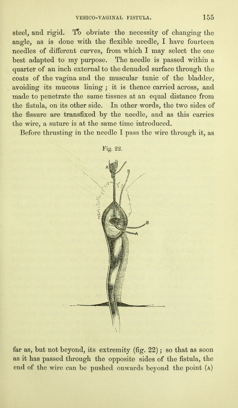 steel, and rigid. To obviate the necessity of changing the angle, as is done with the flexible needle, I have fourteen needles of different curves, from which I may select the one best adapted to my purpose. The needle is passed within a quarter of an inch external to the denuded surface through the coats of the vagina and the muscular tunic of the bladder, avoiding its mucous lining ; it is thence carried across, and made to penetrate the same tissues at an equal distance from the fistula, on its other side. In other words, the two sides of the fissure are transfixed by the needle, and as this carries the wire, a suture is at the same time introduced. Before thrusting in the needle I pass the wire through it, as Fig. 22. far as, but not beyond, its extremity (fig. 22); so that as soon as it has passed through the opposite sides of the fistula, the end of the wire can be pushed onwards beyond the point (a)