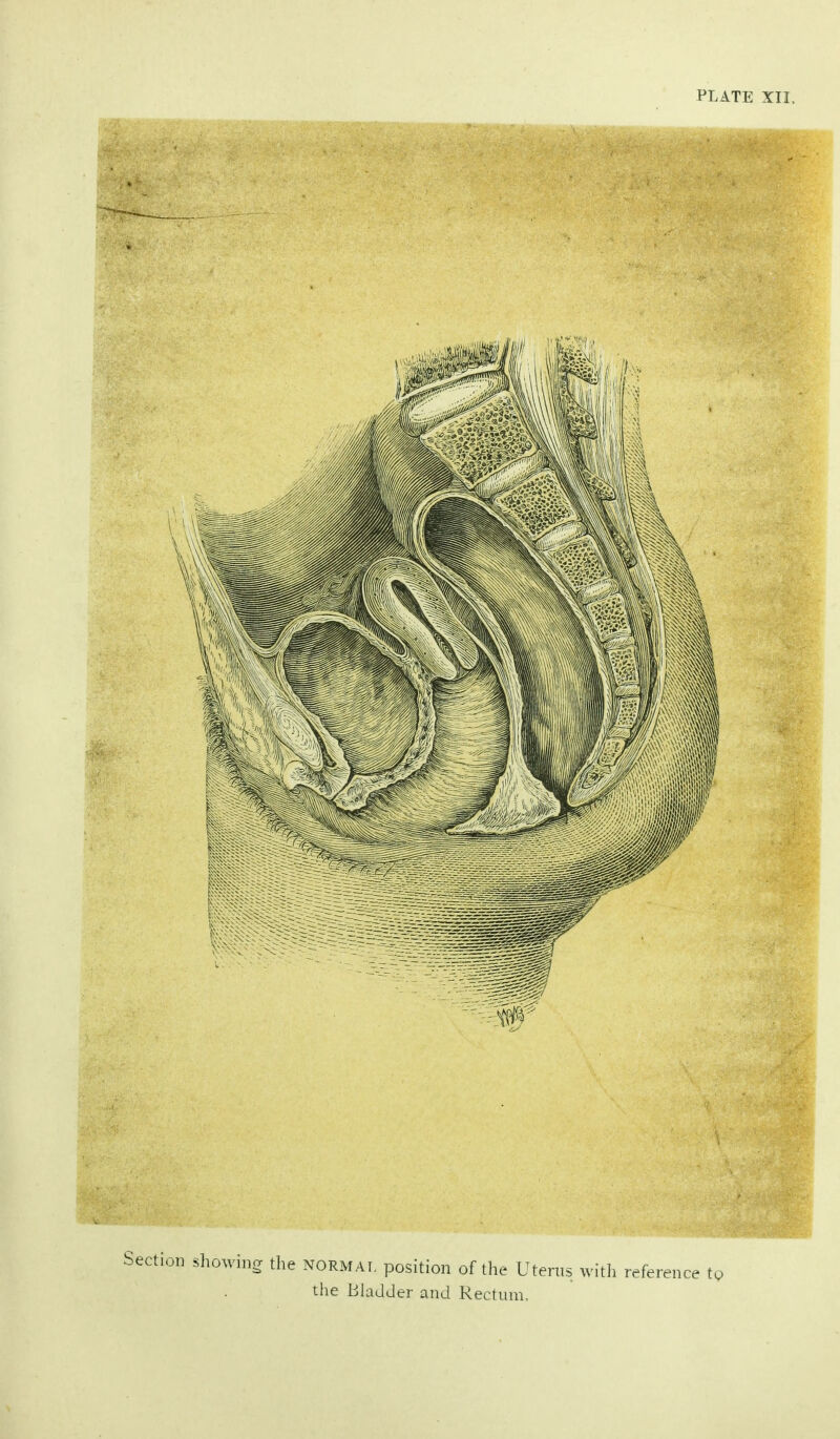 Section showing the normal position of the Uterus with reference to the Bladder and Rectum,