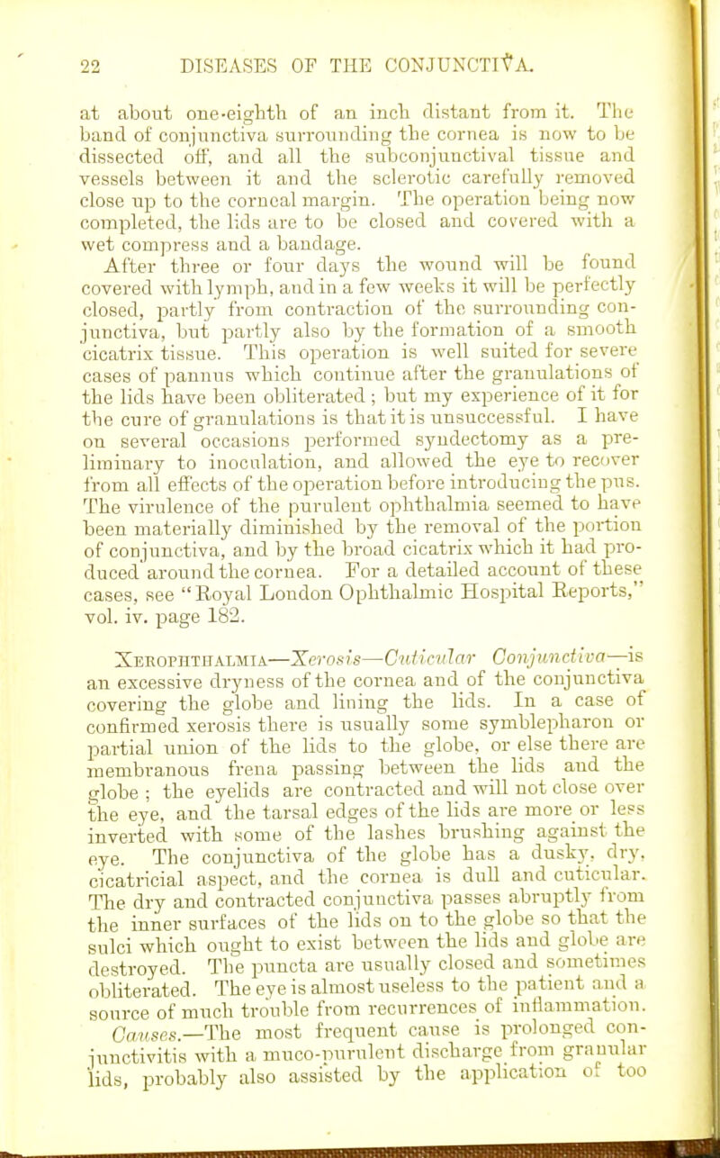 at about one-eighth of an inch distant from it. The band of conjnnctiva surronnding the cornea in now to be dissected off, and all the subconjunctival tissue and vessels between it and the sclerotic carefully removed close up to the corneal margin. The operation being now completed, the lids are to be closed and covered with a wet compress and a bandage. After three or four days the wound will be found covered with lymph, and in a few weeks it will be perfectly closed, partly from contraction of the, surrounding con- junctiva, but partly also by the formation of a smooth cicatrix tissue. This operation is well suited for severe cases of paunus which continue after the granulations ot the lids have been obliterated ; but my experience of it for the cure of granulations is that it is unsuccessful. I have on several occasions performed syudectomy as a pre- liminary to inoculation, and allowed the eye to recover from all effects of the operation before introducing the pus. The virulence of the purulent ophthalmia seemed to have been materially diminished by the removal of the portion of conjunctiva, and by the broad cicatrix which it had pro- duced'around the cornea. For a detailed account of these cases, see Eoyal London Ophthalmic Hospital Reports, vol. iv. page 182. Xerophthalmia—Xerosis—Cuticvlar Conjunctiva—h an excessive dryness of the cornea and of the conjunctiva covering the globe and lining the lids. In a case of confirmed xerosis there is usually some symblepharon or partial union of the lids to the globe, or else there are membranous frena passing between the lids and the globe ; the eyelids are contracted and will not close over the eye, and the tarsal edges of the lids are more or less inverted with some of the lashes brushing against the eye. The conjunctiva of the globe has a dusk3% dry. cicatricial aspect, and the cornea is dull and cuticular. The dry and contracted conjunctiva passes ahruptly from the inner surfaces of the lids on to the globe so that the sulci which ought to exist between the lids and globe are destroyed. Tlie puncta are usually closed and sometimes obliterated. The eye is almost useless to the patient and a source of much trouble from recurrences of inflammation. Qav.ses.—The most frequent cause is prolonged con- junctivitis with a muco-nurulent discharge from granular lids, probably also assisted by the application o. too