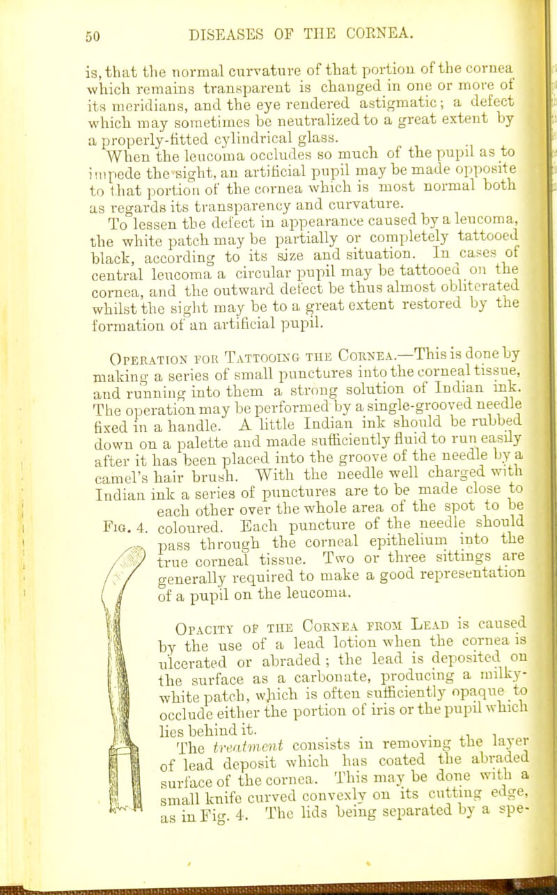 is, that the normal curvature of that portion of the cornea which remains transparent is chauged in one or more of its meridians, and the eye rendered astigmatic; a defect which may sometimes be neutralized to a great extent by a properly-fitted cylindrical glass. When the leucoma occludes so much of the pupil as to impede the sight, an artificial pupil may be made opposite to that portio^n of the cornea which is most normal both as regards its transparency and curvature. To lessen the defect in appearance caused by a leucoma, the white patch may be partially or completely tattooed black, according to its size and situation. In ^cases of central leucoma a circular pupil may be tattooea on the cornea, and the outward defect be thus almost obliterated whilst the sight may be to a great extent restored by the formation of an artificial pupil. Operation fou Tattook& the Corkea.—Thisisdoneby making a series of small punctures iuto the corneal tissue, and running into them a strong solution of Indian ink. The operation may be performed by a single-grooved needle fixed in a handle. A little Indian ink should be rubbed down on a palette and made sufficiently fluid to run easily after it has been placed into the groove of the needle by a camel's hair brush. With the needle well charged with Indian ink a series of punctures are to be made close to each other over the whole area of the spot to be Fig, 4. coloured. Each puncture of the needle should pass through the corneal epithelium into the true corneal tissue. Two or three sittings are generally required to make a good representation of a pupil on the leucoma. Opacity op the Corkea prom Lead is caused by the use of a lead lotion when the cornea is ulcerated or abraded; the lead is deposited on the surface as a carbonate, producing a milky- white patch, which is often sufficiently opaque to occlude either the portion of iris or the pupil which lies behind it. . The treatment consists m removing the layer of lead deposit which has coated the abraded surface of the cornea. This may be done with a small knife curved convexly on its cutting edge, as inFio- 4. The lids being separated by a spe-