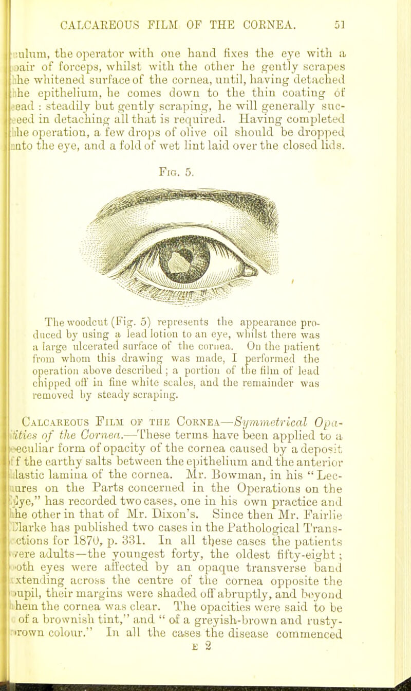 ulum, the operator with one baud fixes the eye witli a lair of forceps, wliilst with the otlier he gently scrapes he wliitened sui'face of the cornea, until, having detached he epithehnm, he comes down to the thin coating of 'ad : steadily but geutly scraping, he will generally snc- ' •ed in detaching all that is rec[uired. Having completed he operation, a few drops of olive oil should be dropped :.nto the e3'e, and a fold of wet lint laid over the closed lids. Fig. 5. The woodcut (Fig. 5) represents the appearance pro- duced by using a lead lotion to an eye, whilst there was a large ulcerated surface of the cornea. On tlie patient from whom this drawing was made, I performed the operation above described ; a portion of the film of lead chipped oft' in fine white scales, and the remainder was removed by steady scraping. Calcareous Film of the Cornea—Symmetrical Opa- idties of the Cornea.—These terms have been applied to a peculiar form of opacity of the cornea caused by a deposit f f the earthy salts between the epithelium and the anterior klastic lamina of the cornea. Mr. Bowman, in his  Lec- aares on the Parts concerned in the Operations on the Ijiye, has recorded two cases> one in his own practice and lihe other in that of Mr. Dixon's. Since then Mr. Fairlie Clarke has published two cases in the Pathological Trans- itions for 1870, p. 331. In all these cases the patients were adults—the youngest forty, the oldest fifty-eight; 'Oth eyes were affected by an opac|ue transverse band xxtending across the centre of the cornea opposite the onpil, tlieir margins were shaded off abruptly, and b(^yond ihemthe cornea was clear. The opacities were said to be of a brownish tint, and  of a greyish-brown and rusty- rurown colour. In all the cases the disease commenced