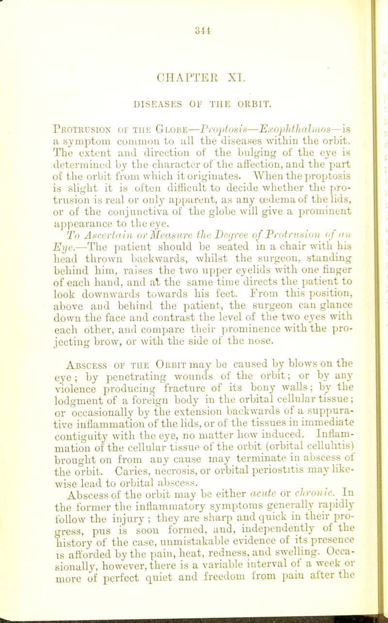 CHAPTER XI. DISEASES OF THE ORBIT. Pbotrdsion of Tim Globe—PnrptoiiiK—E.';op]i.lhaluws—is a S}'mptom common to all the disea.ses within the orbit. The extent and direction of the bulging of the eye is determined by the character of the affection, and the part of the orbit from which it originates. When the proptosis is slight it is often difficult to decide whether the pro- trusion is real or only apparent, as any oedema of the lids, or of the conjunctiva of the globe will give a prominent appearance to the eye. To Ascertain or Measure the Degree of Froiruslon ofii,i Eye.—The patient should be seated in a chair with his head thrown backwards, whilst the surgeon, standing behind him, raises the two upper eyelids with one finger of each hand, and at the same time directs the patient to look downwards towards his feet. From this position, above and behind the patient, the surgeon can glance down the face and contrast the level of the two eyes with each other, and compare tlieir prominence with the pro- jecting brow, or with the side of the nose. Abscess of the Okbit may be caused by blows on the eye; by penetrating wounds of the orbit; or by any violence producing fracture of its bony walls; by the lodgment of a foreign body in the orbital cellular tissue; or occasionally by the extension backwards of a suppura- tive inflammation of the lids, or of the tissues in immediate contiguity with the eye, no matter bow induced. Inflam- mation of the cellular tissue of the orbit (orbital cellulitis) brought on from any cause may terminate in abscess of the oi-bit. Caries, necrosis, or orbital periostitis may like- wise lead to orbital abscess. Abscess of the orbit may be either acute or chronic^ In the former the inflammatory symptoms generally rapidly follow the injury ; they are sharp and quick in their pro- gress, pus is soon formed, and, independently of the history of the case, unmistakable evidence of its presence is afllorded by the pain, heat, redness, and swelling. Occa- sionally, however, there is a variable interval of a week or more of perfect quiet and freedom from pain after the