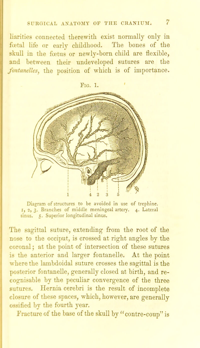 !'uirities connected therewith exist normally only in fi-etal life or early childhood. The bones of the skull in the fcetus or newly-born child are flexible, and between their undeveloped sutures are the fontunelles, the position of which is of importance. Fig. 1. Diagram of structures to be avoided in use of trephine. I, 1, 3. Branches of middle meningeal artery. 4. Lateral sinus. 5. Superior longitudinal sinus. The sagittal suture, extending- from the root of the nose to the occiput, is crossed at rig-ht angles by the coronal; at the point of intersection of these sutures is the anterior and larger fontanelle. At the point where the lambdoidal suture crosses the sagittal is the posterior fontanelle, generally closed at birth, and re- cognisable by the pecuHar convergence of the three sutures. Hernia cerebri is the result of incomplete closure of these spaces, which, however, are generally ossified by the fourth year. Fracture of the base of the skull by contre-coup is