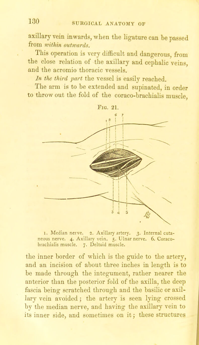 axillary vein inwards, when the ligature can be passed fi'om within outwards. This operation is very difficult and dangerous, from the close relation of the axillary and cephalic veins, and the acromio thoracic vessels. In the third jmrt the vessel is easily reached. The arm is to be extended and supinated, in order to throw out the fold of the coraco-brachialis muscle, Fig. 21. 1. Median nerve. 2. Axillary artery. 3. Internal cuta- neous nerve. 4. Axillary vein. 5. Ulnarnerve. 6. Coraco- brachialis muscle. 7. Deltoid muscle. the inner border of which is the g;uide to the artery, and an incision of about three inches in length is to be made through the integument, rather nearer the anterior than the posterior fold of the axilla, the deep fascia beins,- scratched throuo-h and the basilic or axil- lavj vein avoided; the artery is seen lying crossed by the median nerve, and having the axillary vein to its inner side, and sometimes on it; these structures