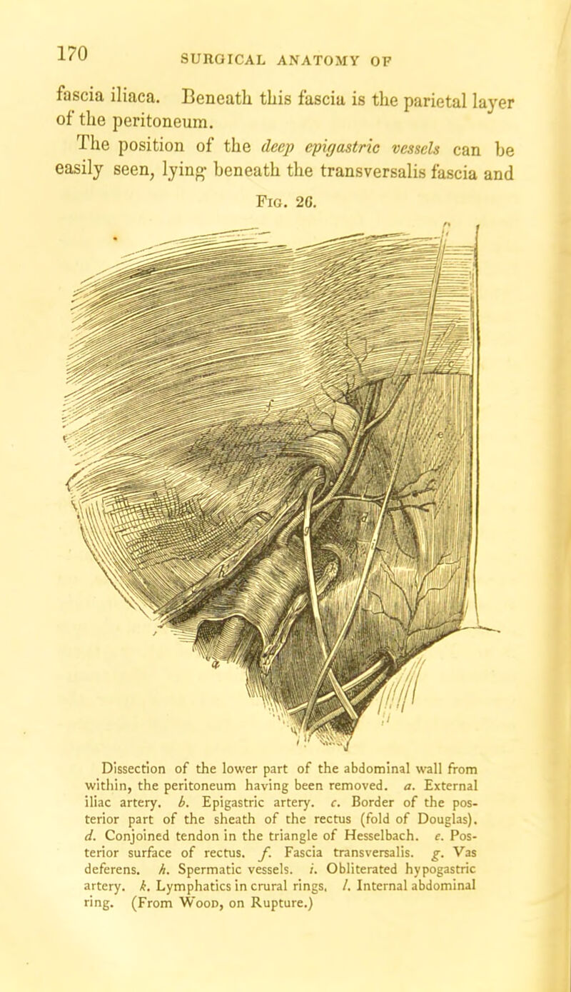 fascia iliaca. Beneath this fascia is the parietal layer of the peritoneum. The position of the deep epigastric vessels can he easily seen, lying- heneath the transversalis fascia and Fig. 2G. Dissection of the lower part of the abdominal W'all from within, the peritoneum having been removed, a. External iliac artery, b. Epigastric artery, c. Border of the pos- terior part of the sheath of the rectus (fold of Douglas). d. Conjoined tendon in the triangle of Hesselbach. e. Pos- terior surface of rectus, f. Fascia transversalis. g. Vas deferens, h. Spermatic vessels. ;. Obliterated hypogastric artery, k. Lymphatics in crural rings, /. Internal abdominal ring. (From Wood, on Rupture.)