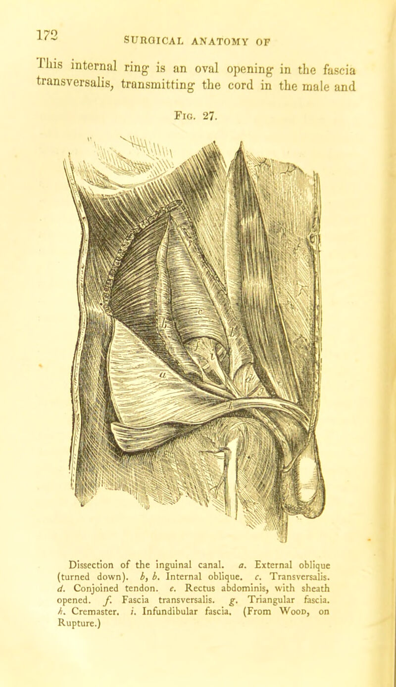 riiis internal ring- is an oval opening- in the fascia transversalis, transmitting the cord in the male and Fig. 27. Dissection of the inguinal canal, a. External oblique (turned down), b, b. Internal oblique, c. Transversalis. d. Conjoined tendon, e. Rectus abdominis, with sheath opened, f. Fascia transversalis. g. Triangular fascia. h. Cremaster. /'. Infundibular fascia, (From Wood, on