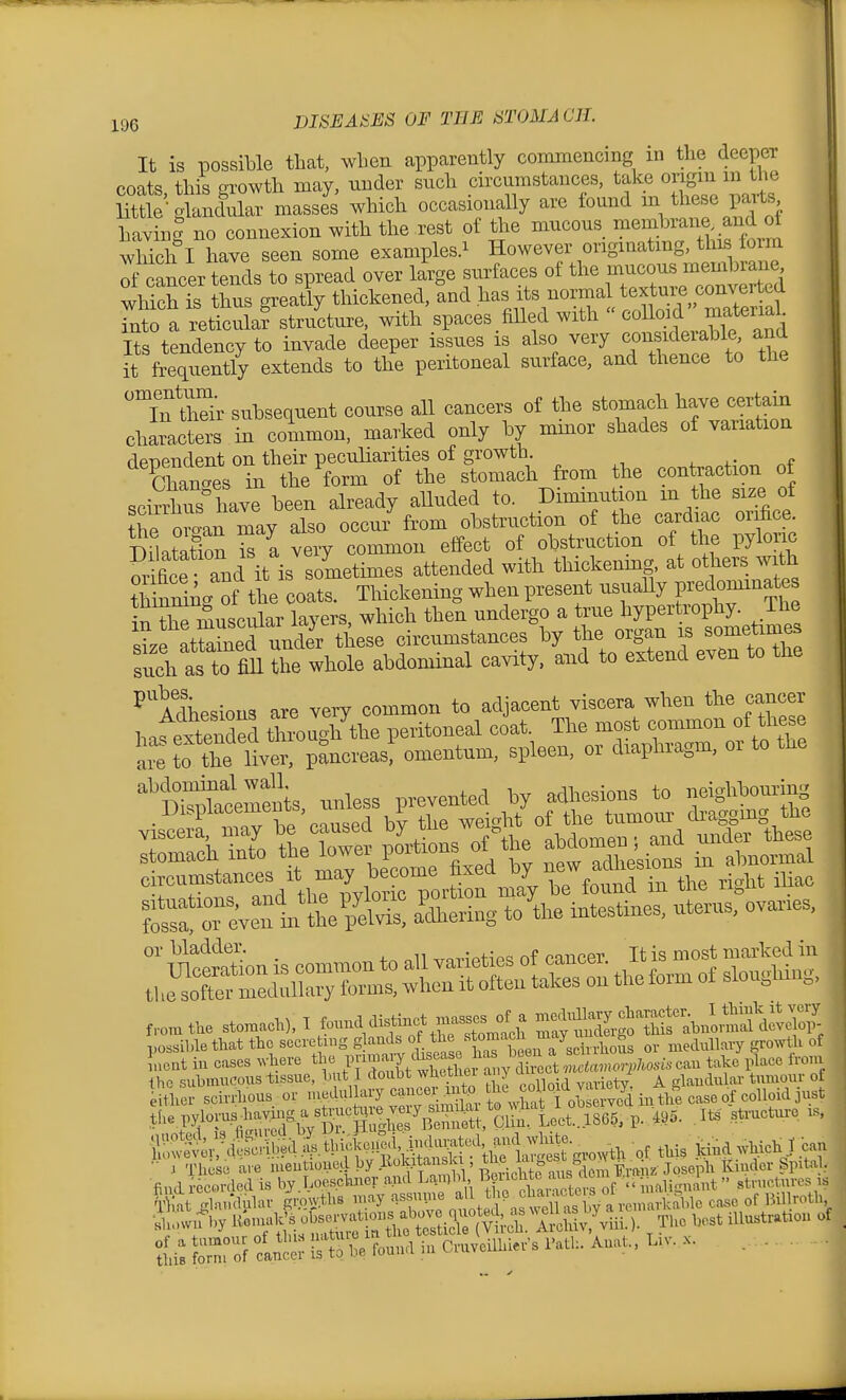 It is possible that, wLen apparently commencing in the deeper coats this orowth may, under such circumstances, take origin m the me-glandular massJs which occasionally are Ibund - these parts havinl no connexion with the rest of the mucous ^^^^J^^^^^l^^^^^^ wMch I have seen some examples.^ However originating, this lorm cancer tends to spread over lige surfaces of the —^^^^^^^^^ which is thus greatly thickened, and has its normal textuie converted Tnto a reticula? str/cture. with spaces fiHed with  coUoad ma^^^^^^^^^ Its tendency to invade deeper issues is also very conquerable and it frequently extends to the peritoneal surface, and thence to the TSr subsequent course all cancers of the stomach ^ave certain characters in common, marked only by mmor shades of variation de-oendent on their peculiarities of growth. Chanc.es in the form of the stomach from the contraction of scirrhTs have been already alluded to. Diminution m the size of ?he o -irray also occu/ from obstruction of the cardiac orihce Matation Ta very common elfect of obstruction of the pyloric Scf and it is sometimes attended with thickening, at others with t Wng of tt coats. Thickening when present usually predominates i^Twuscular layers, which then undergo a true hypertrophy. Ihe slf atoned under these circumstances by the organ is sometimes such as to^ the whole abdominal cavity, and to extend even to the ^'Adhesions are very common to adjacent viscera when the cancer hafeSed tough the peritoneal coat. The most common of the e a?e to the liver, pancreas! omentum, spleen, or diaphragm, or to the circumstances it may become ^xcu uj^ or bladder. ^.mnpHo^ of cancer It is most marked in lucnt in cases .Jere the F^-^;^.^!^™ i an^ t''^ ^'-''^ the submucous tissue, Init I doubt wjittuei a y u . , ^ ^ glaudulai- tumour ot litlter scirfious or medullary caucer ^utp tlie coUo d variety, ^^^^ ^^^^^.^