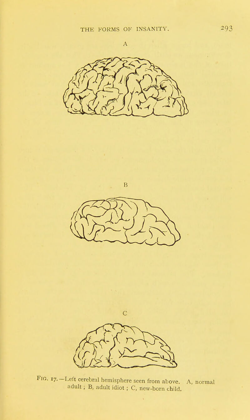 3. 17. —Left cerebral hemisphere seen from above. A, normal