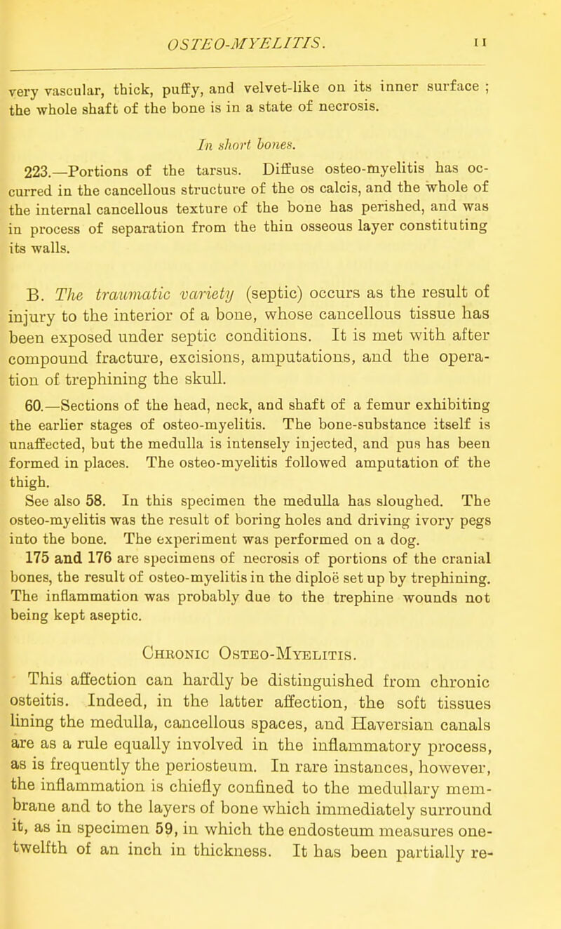 very vascular, thick, puffy, and velvet-like on its inner surface ; the whole shaft of the bone is in a state of necrosis. In short hones. 223.—Portions of the tarsus. Diffuse osteo-myelitis has oc- cui-red in the cancellous structure of the os calcis, and the whole of the internal cancellous texture of the bone has perished, and was in process of separation from the thin osseous layer constituting its walls. B. The trmmiatic variety (septic) occurs as the result of injury to the interior of a bone, whose cancellous tissue has been exposed under septic conditions. It is met with after compound fracture, excisions, amputations, and the opera- tion of trephining the skull. 60.—Sections of the head, neck, and shaft of a femur exhibiting the earlier stages of osteo-myelitis. The bone-substance itself is unaffected, but the medulla is intensely injected, and pus has been formed in places. The osteo-myelitis followed amputation of the thigh. See also 58. In this specimen the medulla has sloughed. The osteo-myelitis was the result of boring holes and driving ivory pegs into the bone. The experiment was performed on a dog. 175 and 176 are specimens of necrosis of portions of the cranial bones, the result of osteo-myelitis in the diploe set up by trephining. The inflammation was probably due to the trephine wounds not being kept aseptic. Chkonic Osteo-Myelitis. This affection can hardly be distinguished from chronic osteitis. Indeed, in the latter affection, the soft tissues lining the medulla, cancellous spaces, and Haversian canals are as a rule equally involved in the inflammatory process, as is frequently the periosteum. In rare instances, however, the inflammation is chiefly confined to the medullary mem- brane and to the layers of bone which immediately surround it, as in specimen 59, in which the endosteum measures one- twelfth of an inch in thickness. It has been partially re-