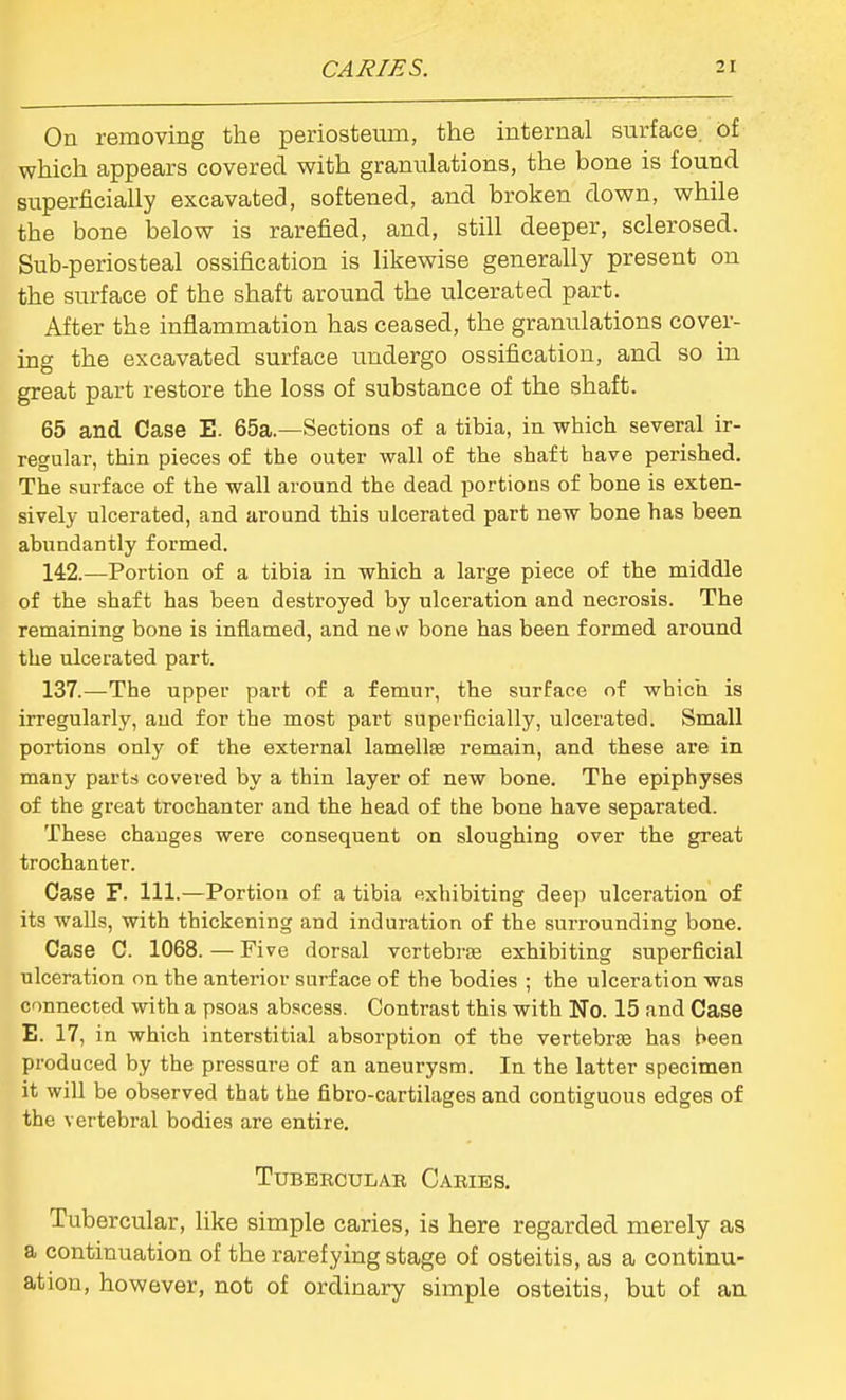 On removing the periosteum, the internal surface, of which appears covered v?ith granulations, the bone is found superficially excavated, softened, and broken down, while the bone below is rarefied, and, still deeper, sclerosed. Sub-periosteal ossification is likewise generally present on the surface of the shaft around the ulcerated part. After the inflammation has ceased, the granulations cover- ing the excavated surface undergo ossification, and so in great part restore the loss of substance of the shaft. 65 and Case E. 65a.—Sections of a tibia, in which several ir- regular, thin pieces of the outer wall of the shaft have perished. The surface of the wall around the dead portions of bone is exten- sively ulcerated, and around this ulcerated part new bone has been abundantly formed. 142.—Portion of a tibia in which a large piece of the middle of the shaft has been destroyed by ulceration and necrosis. The remaining bone is inflamed, and ne vv bone has been formed around the ulcerated part. 137.—The upper part of a femur, the surface of which is irregularly, and for the most part superficially, ulcerated. Small portions only of the external lamellas remain, and these are in many parts covered by a thin layer of new bone. The epiphyses of the great trochanter and the head of the bone have separated. These changes were consequent on sloughing over the great trochanter. Case F. 111.—Portion of a tibia exhibiting deep ulceration of its walls, with thickening and induration of the surrounding bone. Case C. 1068. — Five dorsal vertebrsE exhibiting superficial ulceration on the anterior surface of the bodies ; the ulceration was connected with a psoas abscess. Contrast this with No. 15 and Case E. 17, in which interstitial absorption of the vertebroB has been produced by the pressure of an aneurysm. In the latter specimen it will be observed that the fibro-cartilages and contiguous edges of the vertebral bodies are entire. TUBEBCULAR CabIES. Tubercular, like simple caries, is here regarded merely as a continuation of the rarefying stage of osteitis, as a continu- ation, however, not of ordinary simple osteitis, but of an