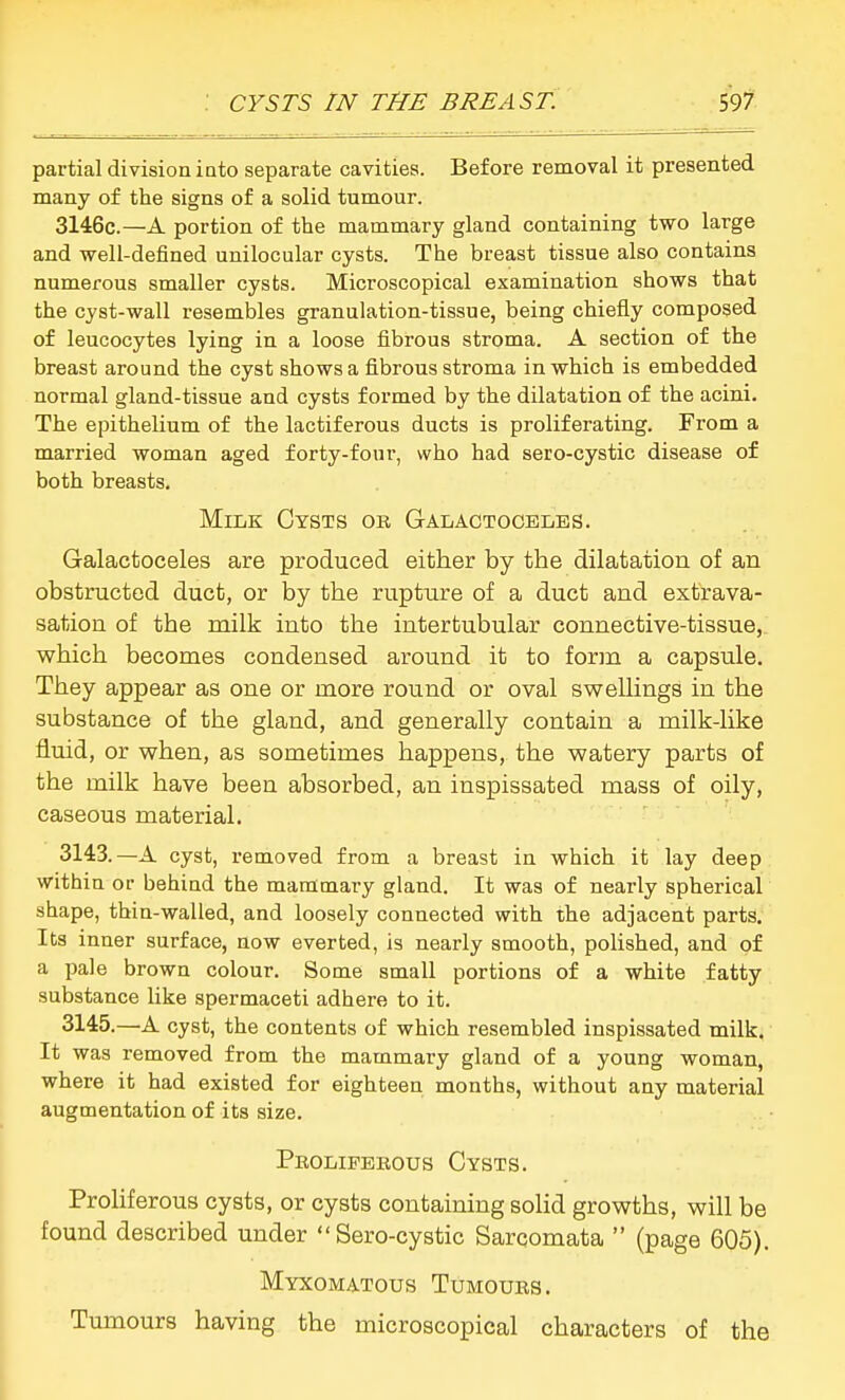 CYSTS IN THE BREAST. i9l partial division into separate cavities. Before removal it presented many of the signs of a solid tumour. 3146c.—A portion of the mammary gland containing two large and well-defined unilocular cysts. The breast tissue also contains numerous smaller cysts. Microscopical examination shows that the cyst-wall resembles granulation-tissue, being chiefly composed of leucocytes lying in a loose fibrous stroma. A section of the breast around the cyst shows a fibrous stroma in which is embedded normal gland-tissue and cysts formed by the dilatation of the acini. The epithelium of the lactiferous ducts is proliferating. From a married woman aged forty-four, who had sero-cystic disease of both breasts. Milk Cysts ob Galactoceles. Galactoceles are produced either by the dilatation of an obstructed ducfc, or by the rupture of a duct and extrava- sation of the milk into the intertubular connective-tissue, which becomes condensed around it to form a capsule. They appear as one or more round or oval swellings in the substance of the gland, and generally contain a milk-like fluid, or when, as sometimes happens, the watery parts of the milk have been absorbed, an inspissated mass of oily, caseous material. 3143.—A cyst, removed from a breast in which it lay deep within or behind the mammary gland. It was of nearly spherical shape, thin-walled, and loosely connected with the adjacent parts. Its inner surface, now everted, is nearly smooth, polished, and of a pale brown colour. Some small portions of a white fatty substance like spermaceti adhere to it. 3145.—A cyst, the contents of which resembled inspissated milk. It was removed from the mammary gland of a young woman, where it had existed for eighteen months, without any material augmentation of its size. Pkoliferous Cysts. Proliferous cysts, or cysts containing soHd growths, will be found described under  Sero-cystic Sarcomata  (page 605). Myxomatous Tumours. Tumours having the microscopical characters of the