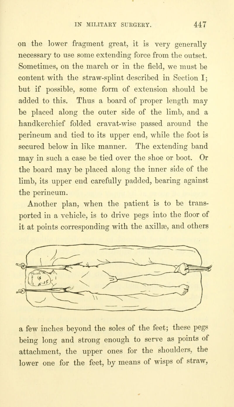on the lower fragment great, it is very generally necessary to use some extending force from the outset. Sometimes, on the march or in the field, we must be content with the straw-splint described in Section I; but if possible, some form of extension should be added to this. Thus a board of proper length may be placed along the outer side of the limb, and a handkerchief folded cravat-wise passed around the perineum and tied to its upper end, while the foot is secured below in like manner. The extending band may in such a case be tied over the shoe or boot. Or the board may be placed along the inner side of the limb, its upper end carefully padded, bearing against the perineum. Another plan, when the patient is to be trans- ported in a vehicle, is to drive pegs into the floor of it at points corresponding with the axillae, and others a few inches beyond the soles of the feet; these pegs being long and strong enough to serve as points of attachment, the upper ones for the shoulders, the lower one for the feet, by means of wisps of straw,