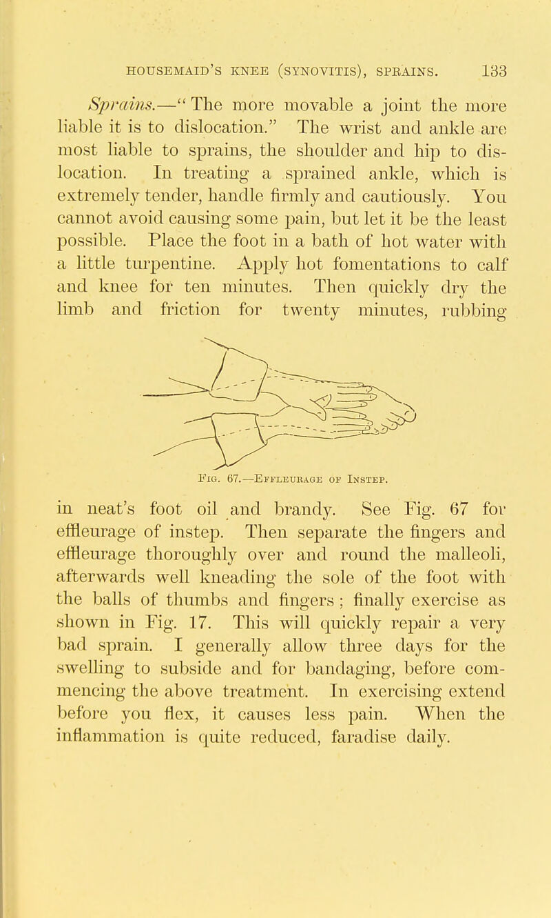 Sprains.— The more movable a joint the more liable it is to dislocation. The wrist and ankle are most liable to sprains, the shoulder and hip to dis- location. In treating a sprained ankle, which is extremely tender, handle firmly and cautiously. You cannot avoid causing some pain, but let it be the least possible. Place the foot in a bath of hot water with a little turpentine. Apply hot fomentations to calf and knee for ten minutes. Then quickly dry the limb and friction for twenty minutes, rubbing Fig. 67.—Effleurage of Instep. in neat's foot oil and brandy. See Fig. 67 for effleurage of instej). Then separate the fingers and effleurage thoroughly over and round the malleoli, afterwards well kneading the sole of the foot with the balls of thumbs and fingers ; finally exercise as shown in Fig. 17. This will quickly repair a very bad sprain, I generally allow three days for the swelling to subside and for bandaging, before com- mencing the above treatment. In exercising extend before you flex, it causes less pain. When the inflammation is quite reduced, faradise daily.