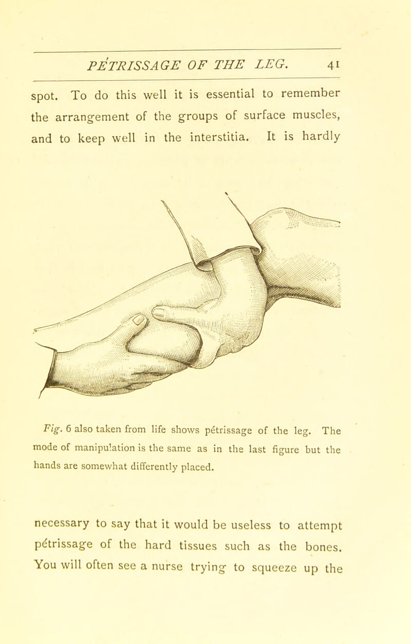 spot. To do this well it is essential to remember the arrangement of the groups of surface muscles, and to keep well in the interstitia. It is hardly Fig. 6 also taken &om life shows petrissage of the leg. The mode of manipulation is the same as in the last figure but the hands are somewhat differently placed. necessary to say that it would be useless to attempt petrissage of the hard tissues such as the bones. You will often see a nurse trying to squeeze up the