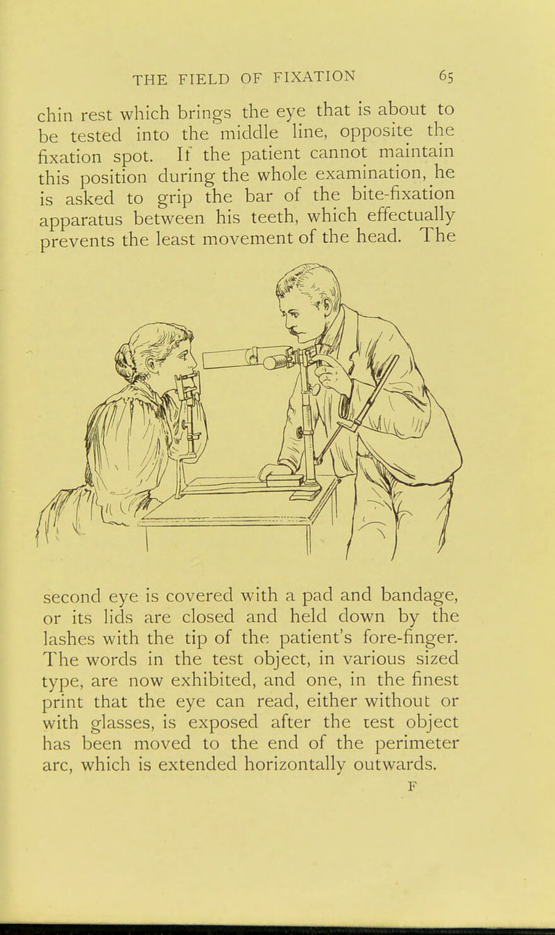 chin rest which brings the eye that is about to be tested into the'middle Hne, opposite the fixation spot. It the patient cannot maintain this position during the whole examination, he is asked to grip the bar of the bite-fixation apparatus between his teeth, which effectually prevents the least movement of the head. The second eye is covered with a pad and bandage, or its lids are closed and held down by the lashes with the tip of the patient's fore-finger. The words in the test object, in various sized type, are now exhibited, and one, in the finest print that the eye can read, either without or with glasses, is exposed after the test object has been moved to the end of the perimeter arc, which is extended horizontallv outwards. F