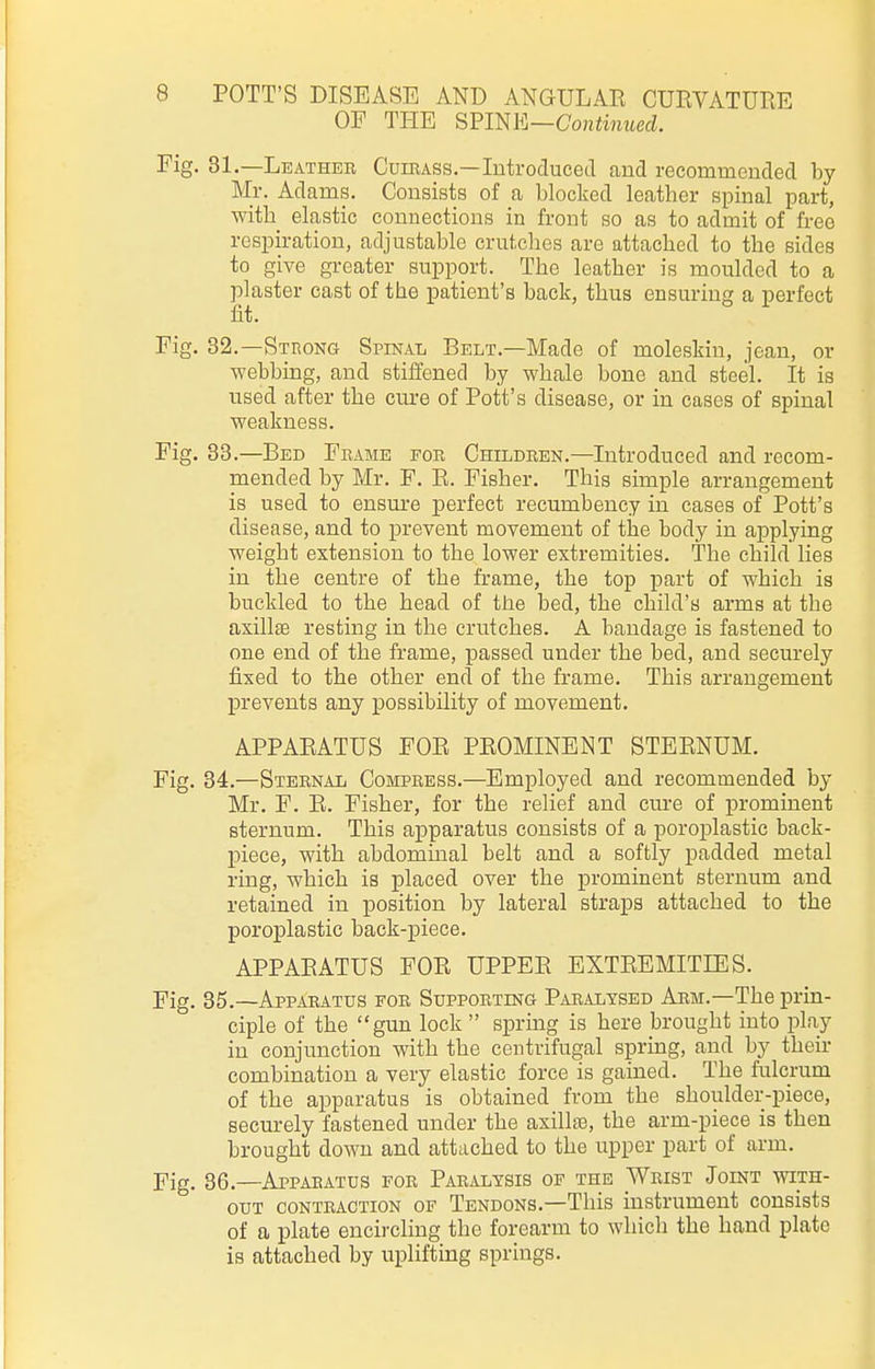 OF THE Snm]—Continued. Fig. 81.—Leather Cuirass.—Introduced and recommended by- Mr. Adams. Consists of a blocked leather spinal part, with elastic connections in front so as to admit of free respiration, adjustable crutches are attached to the sides to give greater support. The leather is moulded to a plaster cast of the patient's back, thus ensuring a perfect fit. Fig. 32.—Strong Spinal Belt.—Made of moleskin, jean, or webbing, and stiffened by whale bone and steel. It is used after the cure of Pott's disease, or in cases of spinal weakness. Fig. 33.—Bed Frame FOR Children.—Introduced and recom- mended by Mr. F. E. Fisher. This simple arrangement is used to ensm-e perfect recumbency in cases of Pott's disease, and to prevent movement of the body in applying weight extension to the lower extremities. The child lies in the centre of the frame, the top part of which is buckled to the head of the bed, the child's arms at the axillas resting in the crutches. A bandage is fastened to one end of the frame, passed under the bed, and securely fixed to the other end of the frame. This arrangement prevents any possibility of movement. APPAEATUS FOE PEOMINENT STEENUM. Fig. 34.—Sternal Compress.—Employed and recommended by Mr. F. E. Fisher, for the relief and cm-e of prominent sternum. This apparatus consists of a poroplastic back- piece, with abdommal belt and a softly padded metal ring, which is placed over the prominent sternum and retained in position by lateral straps attached to the poroplastic back-piece. APPAEATUS FOE UPPEE EXTEEMITIES. Fig. 35.—Apparatus for Supporting Paralysed Arm.—The prin- ciple of the gun lock  spring is here brought into play in conjunction with the centrifugal spring, and by their combination a very elastic force is gained. The fulcrum of the apparatus is obtained from the shoulder-piece, securely fastened under the axillse, the arm-piece is then brought down and attached to the upper part of arm. Fig. 86.—Apparatus for Paralysis of the Wrist Joint with- out CONTRACTION OF Tendons.—This instrument consists of a plate encircling the forearm to which the hand plate is attached by uplifting springs.
