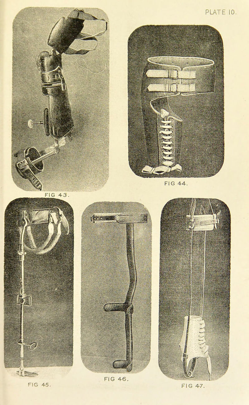 FIG 4-5. 1- IC:, 4-7.