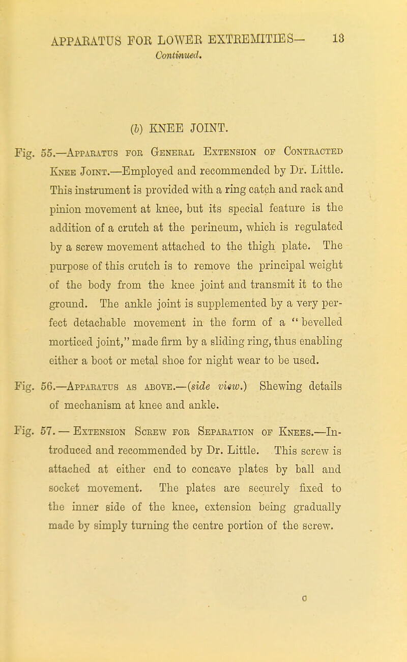 Continued, (&) KNEE JOINT. Fig. 55.—Appabatus for General Extension of Contracted Knee Joint.—Employed and recommended by Dr. Little. This instrument is provided with a ring catch and rack and pinion movement at knee, but its special feature is the addition of a crutch at the perineum, which is regulated by a screw movement attached to the thigh plate. The purpose of this crutch is to remove the principal weight of the body from the knee joint and transmit it to the ground. The ankle joint is supplemented by a very per- fect detachable movement in the form of a  bevelled morticed joint, made firm by a sliding ring, thus enabling either a boot or metal shoe for night wear to be used. Fig. 56.—Apparatus as above.—{side view.) Shewing details of mechanism at knee and ankle. Fig. 67. — Extension Screw for Separation of Knees.—In- troduced and recommended by Dr. Little. This screw is attached at either end to concave plates by ball and socket movement. The plates are securely fixed to the inner side of the knee, extension being gradually made by simply turning the centre portion of the screw. 0