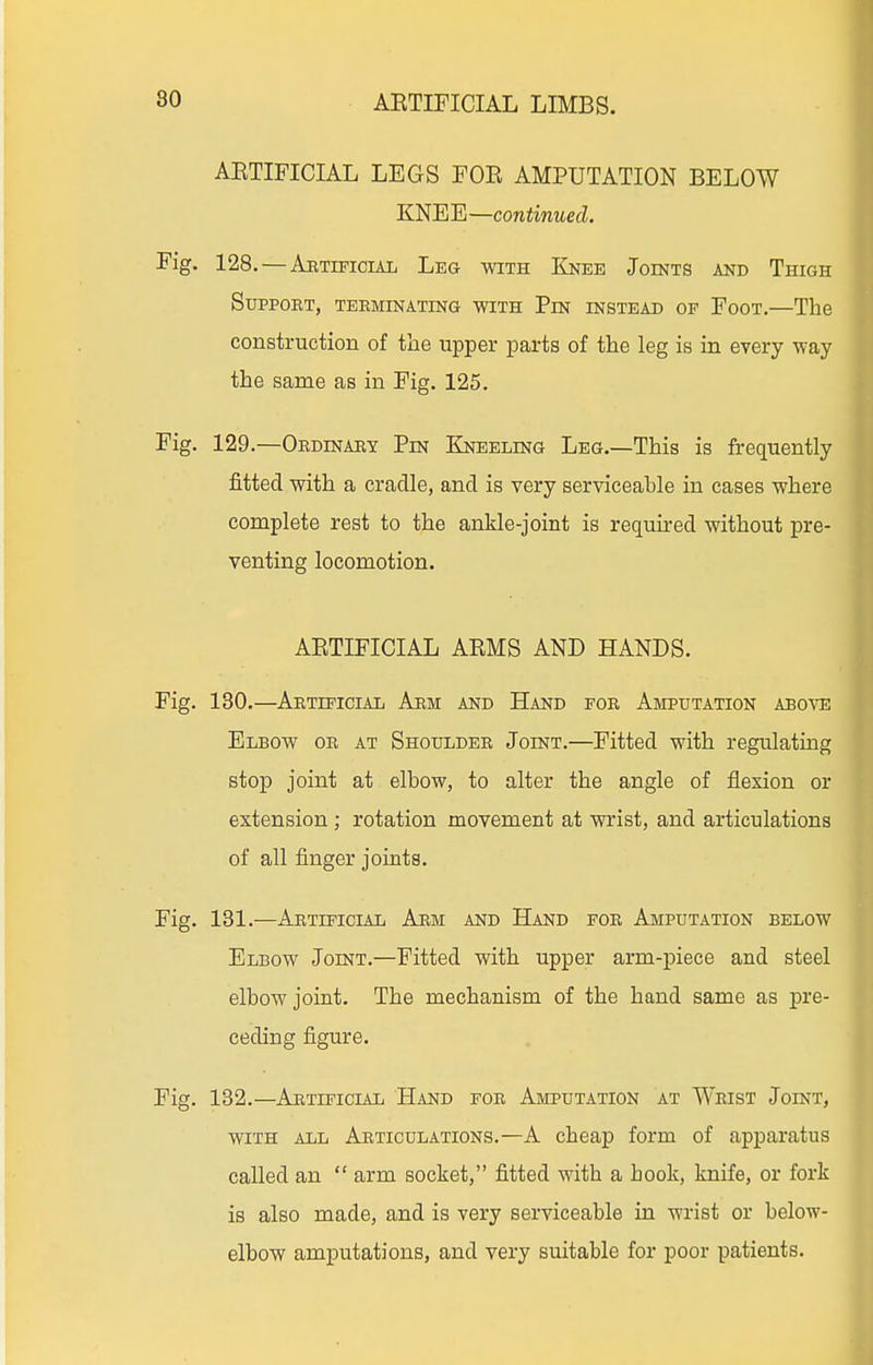 80 AETIFICIAL LEGS FOE AMPUTATION BELOW KNEE—con«mMefZ. Fig. 128. — Artificial Leg with Knee Joints and Thigh SUPPOET, TEEMINATING WITH PiN INSTEAD OF FoOT.—The construction of the upper parts of the leg is in every way the same as in Fig. 125. Fig. 129.—Ordinary Pin Kneeling Leg.—This is frequently fitted with a cradle, and is very serviceable in cases where complete rest to the ankle-joint is required without pre- venting locomotion. AETIFICIAL AEMS AND HANDS. Fig. 180.—Artificial Arm and Hand for Amputation above Elbow or at Shoulder Joint.—Fitted with regulating stop joint at elbow, to alter the angle of flexion or extension ; rotation movement at wrist, and articulations of all finger joints. Fig. 181.—Artificial Arm and Hand for Amputation below Elbow Joint.—Fitted with upper arm-piece and steel elbow joint. The mechanism of the hand same as pre- ceding figure. Fig. 132.—Artificial Hand for Amputation at Wrist Joint, with all Articulations.—A cheap form of apparatus called an  arm socket, fitted with a book, knife, or fork is also made, and is very serviceable in wrist or below- elbow amputations, and very suitable for poor patients.