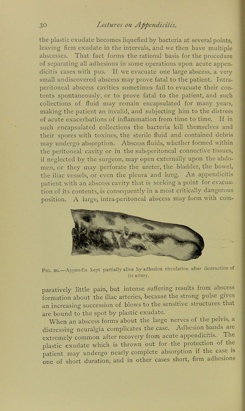 the plastic exudate becomes liquefied by bacteria at several points, leaving firm exudate in the intervals, and we then have multiple abscesses. That fact forms the rational basis for the procedure of separating all adhesions in some operations upon acute appen- dicitis cases with pus. If we evacuate one large abscess, a very- small undiscovered abscess may prove fatal to the patient. Intra- peritoneal abscess cavities sometimes fail to evacuate their con- tents spontaneously, or to prove fatal to the patient, and such collections of fluid may remain encapsulated for many years, making the patient an invalid, and subjecting him to the distress of acute exacerbations of inflammation from time to time. If in such encapsulated collections the bacteria kill themselves and their spores with toxines, the sterile fluid and contained debris may undergo absorption. Abscess fluids, whether formed within the peritoneal cavity or in the sub-peritoneal connective tissues, if neglected by the surgeon, may open externally upon the abdo- men, or they may perforate the ureter, the bladder, the bowel, the iliac vessels, or even the pleura and lung. An appendicitis patient with an abscess cavity that is seeking a point for evacua- tion of its contents, is consequently in a most critically dangerous position. A large, intra-peritoneal abscess may form with com- FiG. 20.—Appendix kept partially alive by adhesion circulation after destruction of its artery. paratively little pain, but intense suffering results from abscess formation about the iliac arteries, because the strong pulse gives an increasing succession of blows to the sensitive structures that are bound to the spot by plastic exudate. When an abscess forms about the large nerves of the pelvis, a distressing neuralgia complicates the case. Adhesion bands are extremely common after recovery from acute appendicitis. The plastic exudate which is thrown out for the protection of the patient may undergo nearly complete absorption if the case is one of short duration, and in other cases short, firm adhesions