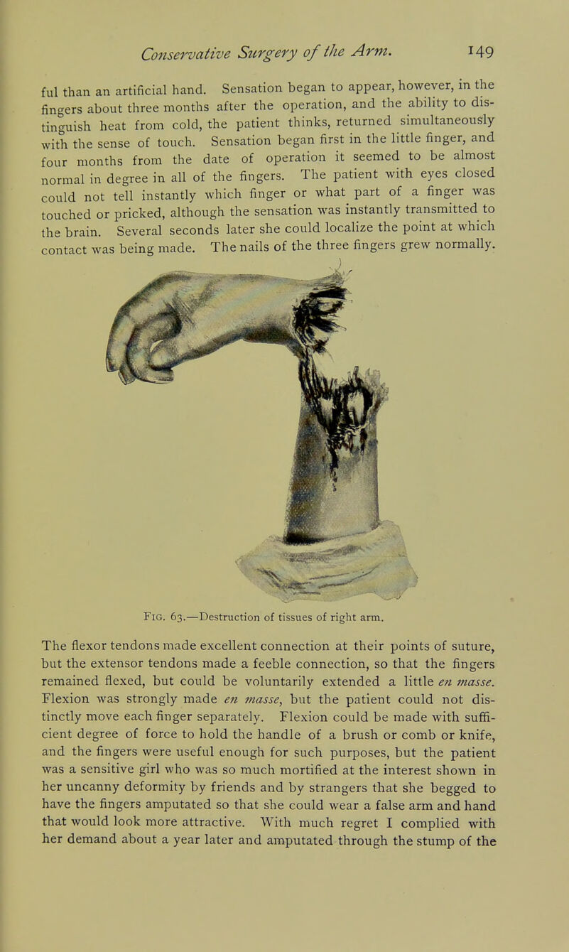 ful than an artificial hand. Sensation began to appear, however, in the fingers about three months after the operation, and the ability to dis- tinguish heat from cold, the patient thinks, returned simultaneously with the sense of touch. Sensation began first in the little finger, and four months from the date of operation it seemed to be almost normal in degree in all of the fingers. The patient with eyes closed could not tell instantly which finger or what part of a finger was touched or pricked, although the sensation was instantly transmitted to the brain. Several seconds later she could localize the point at which contact was being made. The nails of the three fingers grew normally. The flexor tendons made excellent connection at their points of suture, but the extensor tendons made a feeble connection, so that the fingers remained flexed, but could be voluntarily extended a little en tnasse. Flexion was strongly made en masse, but the patient could not dis- tinctly move each finger separately. Flexion could be made with suffi- cient degree of force to hold the handle of a brush or comb or knife, and the fingers were useful enough for such purposes, but the patient was a sensitive girl who was so much mortified at the interest shown in her uncanny deformity by friends and by strangers that she begged to have the fingers amputated so that she could wear a false arm and hand that would look more attractive. With much regret I complied with her demand about a year later and amputated through the stump of the