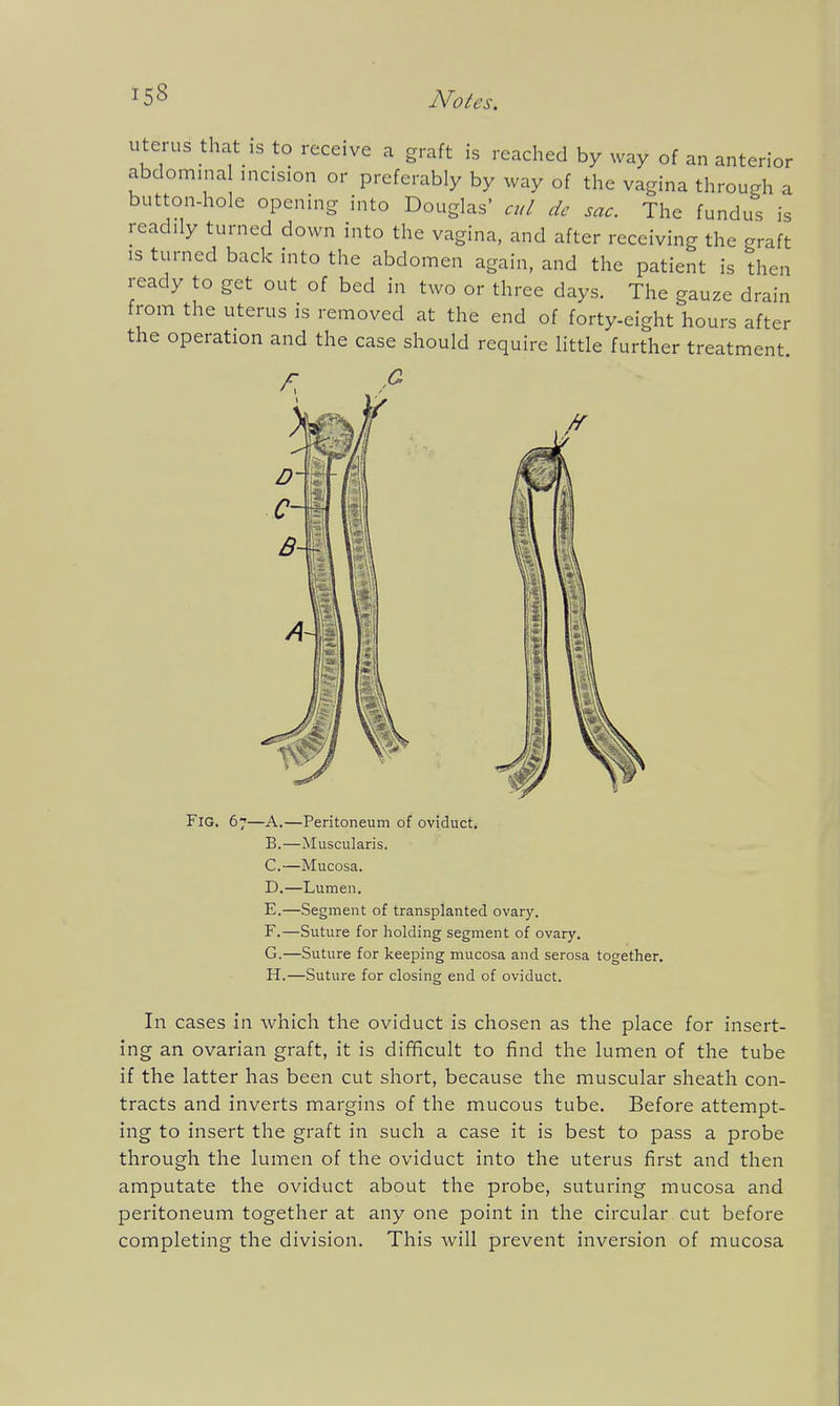 uterus that is to receive a graft is reached by way of an anterior abdominal incision or preferably by way of the vagina through a button-hole opening into Douglas' ml dc sac. The fundus is readily turned down into the vagina, and after receiving the graft is turned back into the abdomen again, and the patient is then ready to get out of bed in two or three days. The gauze drain from the uterus is removed at the end of forty-eight hours after the operation and the case should require little further treatment. C Fig. 67—A.—Peritoneum of oviducts B. —Muscularis. C. —Mucosa. D. —Lumen. E. —Segment of transplanted ovary. F. —Suture for holding segment of ovary. G. —Suture for keeping mucosa and serosa together. H. —Suture for closing end of oviduct. In cases in which the oviduct is chosen as the place for insert- ing an ovarian graft, it is difficult to find the lumen of the tube if the latter has been cut short, because the muscular sheath con- tracts and inverts margins of the mucous tube. Before attempt- ing to insert the graft in such a case it is best to pass a probe through the lumen of the oviduct into the uterus first and then amputate the oviduct about the probe, suturing mucosa and peritoneum together at any one point in the circular cut before completing the division. This will prevent inversion of mucosa