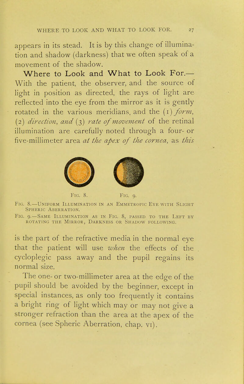 appears in its stead. It is by this change of illumina- tion and shadow (darkness) that we often speak of a movement of the shadow. Where to Look and What to Look For.— With the patient, the observer, and the source of light in position as directed, the rays of light are reflected into the eye from the mirror as it is gently rotated in the various meridians, and the (i) form, (2) direction, and (3) rate of movernent of the retinal illumination are carefully noted through a four- or five-millimeter area at the apex of the cornea, as this Fig. 8. Fig. 9. Fig. 8.—Uniform Illumination in an Emmetropic Eye with Slight Spheric Aberration. Fig. 9.—Same Illumination as in Fig. 8, passed to the Left by ROTATING the MlRROR, DARKNESS OR SHADOW FOLLOWING. is the part of the refractive media in the normal eye that the patient will use when the effects of the cycloplegic pass away and the pupil regains its normal size. The one- or two-millimeter area at the edee of the pupil should be avoided by the beginner, except in special instances, as only too frequently it contains a bright ring of light which may or may not give a stronger refraction than the area at the apex of the cornea (see Spheric Aberration, chap. vi).