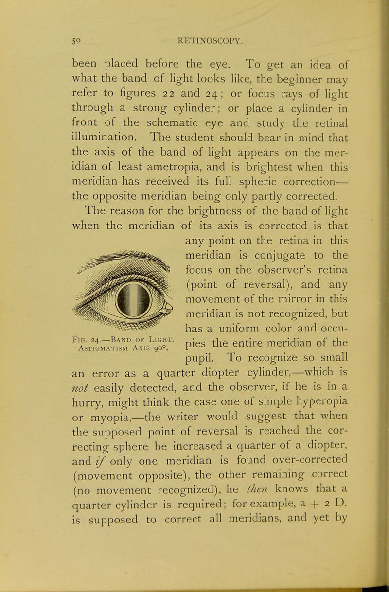 been placed before the eye. To get an idea of what the band of hght looks like, the beginner may refer to figures 22 and 24; or focus rays of light through a strong cylinder; or place a cylinder in front of the schematic eye and study the retinal illumination. The student should bear in mind that the axis of the band of light appears on the mer- idian of least ametropia, and is brightest when this meridian has received its full spheric correction— the opposite meridian being only partly corrected. The reason for the brightness of the band of light when the meridian of its axis is corrected is that any point on the retina in this meridian is conjugate to the focus on the observer's retina (point of reversal), and any movement of the mirror in this meridian is not recognized, but has a uniform color and occu- pies the entire meridian of the pupil. To recognize so small an error as a quarter diopter cylinder,—which is not easily detected, and the observer, if he is in a hurry, might think the case one of simple hyperopia or myopia,—the writer would suggest that when the supposed point of reversal is reached the cor- recting sphere be increased a quarter of a diopter, and if only one meridian is found over-corrected (movement opposite), the other remaining correct (no movement recognized), he then knows that a quarter cylinder is required; for example, a -j- 2 D. is supposed to correct all meridians, and yet by