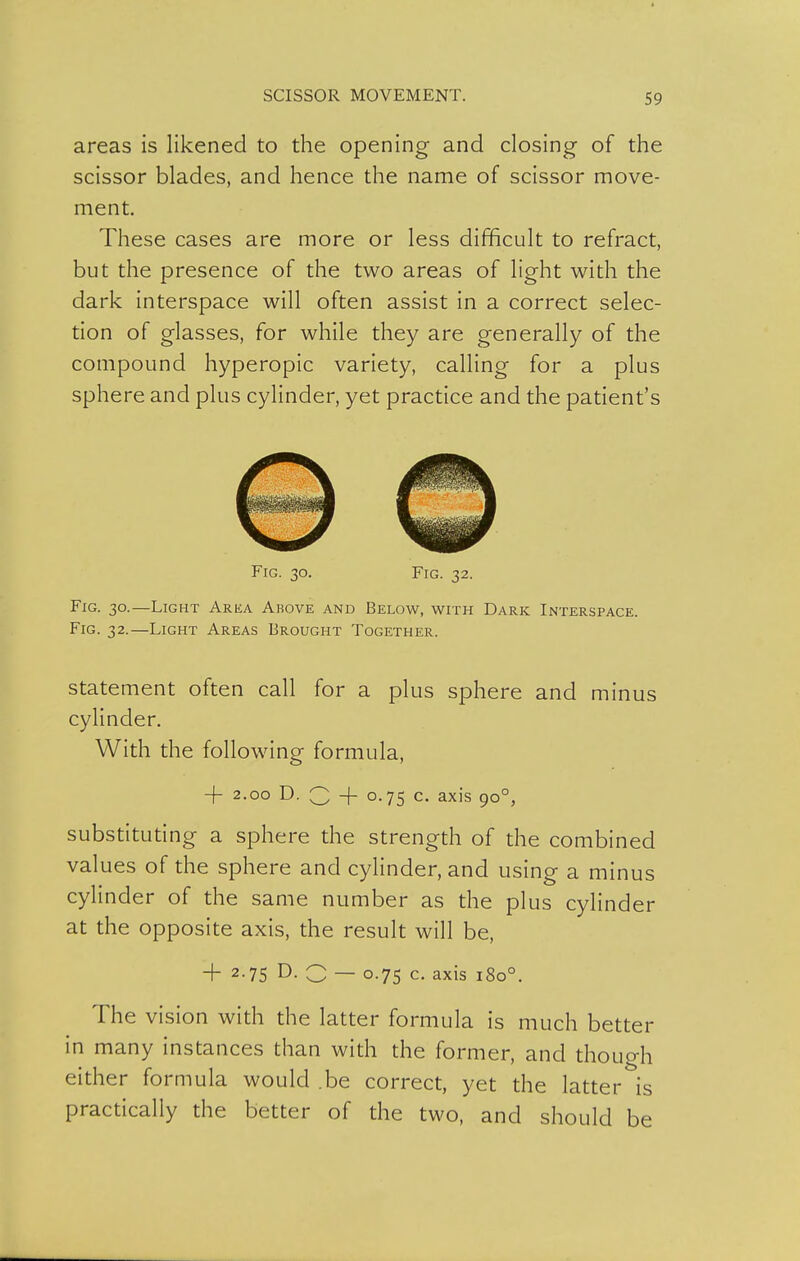 areas is likened to the opening and closing of the scissor blades, and hence the name of scissor move- ment. These cases are more or less difficult to refract, but the presence of the two areas of light with the dark interspace will often assist in a correct selec- tion of glasses, for while they are generally of the compound hyperopic variety, calling for a plus sphere and plus cylinder, yet practice and the patient's Fig. 30. Fig. 32. Fig. 30.—Light Area Above and Below, with Dark Interspace. Fig. 32.—Light Areas Brought Together. Statement often call for a plus sphere and minus cylinder. With the following formula, -f 2.00 D. Q -f 0.75 c. axis 90°, substitudng a sphere the strength of the combined values of the sphere and cylinder, and using a minus cylinder of the same number as the plus cylinder at the opposite axis, the result will be, + 2.75 D. Q — 0.75 c. axis 180°. The vision with the latter formula is much better in many instances than with the former, and though either formula would .be correct, yet the latter is pracdcally the better of the two, and should be