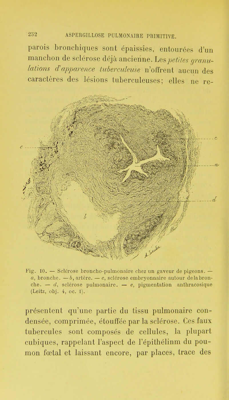 2S2 parois bronchiques sont épaissies, entourées d'un manchon de sclérose déjà ancienne. Les petites </mnu- lations d'apparence tuberculeuse n'offrent aucun des caractères des lésions tuberculeuses; elles ne re- -C Fig. 10. — Sclérose broncho-pulmonaire chez un gaveur de pigeons. — a, bronche. —b, artère. — c, sclérose embryonnaire autour delabron- che. — d, sclérose pulmonaire. — e, pigmentation anthracosique (Leitz, obj. 4, oc. 1). présentent qu'une partie du tissu pulmonaire con- densée, comprimée, étouffée par la sclérose. Ces faux tubercules sont composés de cellules, la plupart cubiques, rappelant l'aspect de l'épithélinm du pou- mon fœtal et laissant encore, par places, trace des
