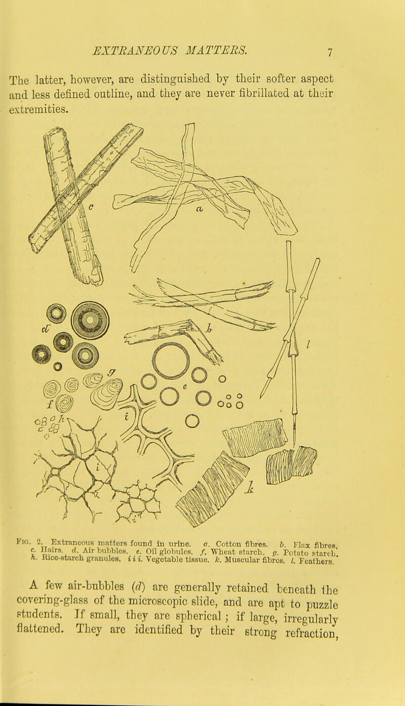 The latter, however, are distinguished by their softer aspect and less defined outline, and they are never fibrillated at their extremities. Fio. 2, Extraneous matters found in urine. a. Cotton fibres. b. Flat fibres c. Hairs d. Air bubbles, e. Oil globules. /. Wheat starch, g. Potato starch' I«cc-staroh granules, i i i. Vegetable- tissue, k. Muscular fibres. 1. Feathers.' A few air-bubbles (d) are generally retained beneath ihe covering-glass of the microscopic slide, and are apt to puzzle students. If small, they are spherical; if large, irregularly flattened. They are identified by their strong refraction,