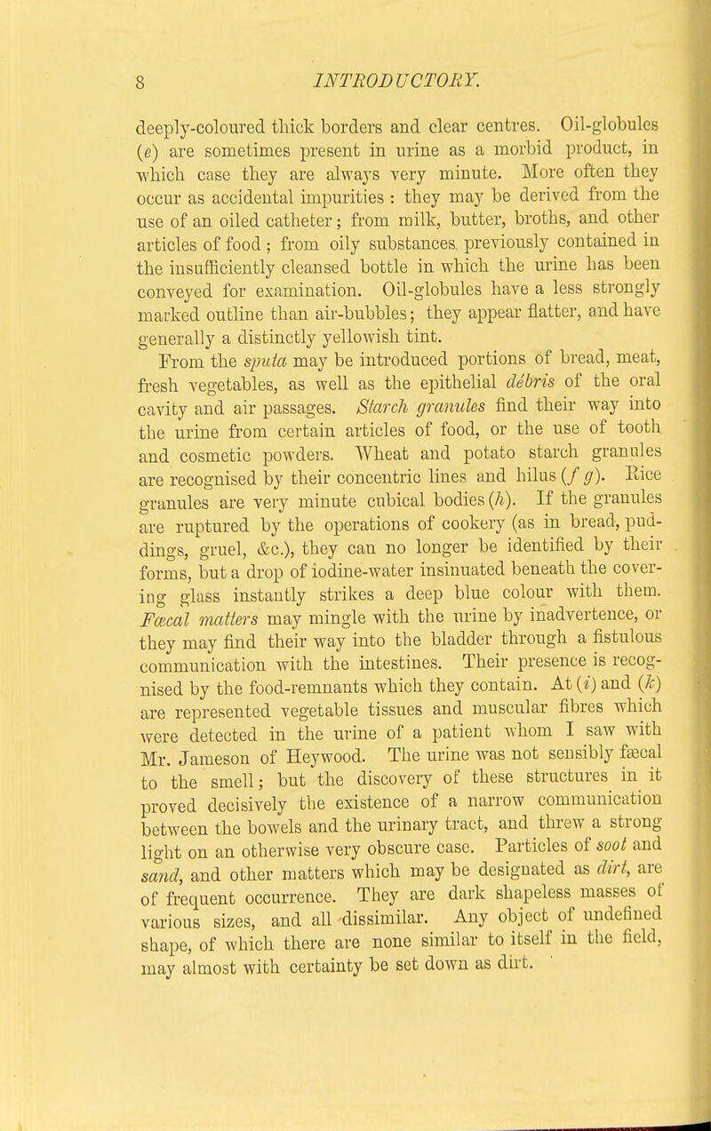deeply-coloured thick borders and clear centres. Oil-globules (e) are sometimes present in urine as a morbid product, in which case they are always very minute. More often they occur as accidental impurities : they may be derived from the use of an oiled catheter; from milk, butter, broths, and other articles of food ; from oily substances, previously contained in the insufficiently cleansed bottle in which the urine has been conveyed for examination. Oil-globules have a less strongly marked outline than air-bubbles; they appear flatter, and have generally a distinctly yellowish tint. From the sputa may be introduced portions of bread, meat, fresh vegetables, as well as the epithelial debris of the oral cavity and air passages. Starch granules find their way into the urine from certain articles of food, or the use of tooth and cosmetic powders. Wheat and potato starch granules are recognised by their concentric lines and hilus (/ g). Rice granules are very minute cubical bodies (h). If the granules are ruptured by the operations of cookery (as in bread, pud- dings, gruel, &c), they can no longer be identified by their forms, but a drop of iodine-water insinuated beneath the cover- ing glass instantly strikes a deep blue colour with them. Faical matters may mingle with the urine by inadvertence, or they may find their way into the bladder through a fistulous communication with the intestines. Their presence is recog- nised by the food-remnants which they contain. At (*) and (k) are represented vegetable tissues and muscular fibres which were detected in the urine of a patient whom I saw with Mr. Jameson of Heywood. The urine was not sensibly faacal to the smell; but the discovery of these structures in it proved decisively the existence of a narrow communication between the bowels and the urinary tract, and threw a strong- light on an otherwise very obscure case. Particles of soot and sand, and other matters which may be designated as dirt, are of frequent occurrence. They are dark shapeless masses of various sizes, and all dissimilar. Any object of undefined shape, of which there are none similar to itself in the field, may almost with certainty be set down as dirt.