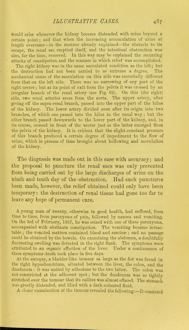 would arise whenever the kidney became distended with urine beyond a certain point; and that when the increasing accumulation of urine at length overcame—in the manner already explained—the obstacle to its escape, the renal sac emptied itself, and the intestinal obstruction was also, for the time, removed. In this way may be explained the recurring attacks of constipation and the manner in which relief was accomplished. The right kidney was in the same sacculated condition as the left; but the destruction had not been carried to so extreme a degree. The mechanical cause of the sacculation on this side was essentially different from that on the left side. There was no narrowing of any part of the right ureter; but at its point of exit from the pelvis it was crossed by an irregular branch of the renal artery (see Fig. 62). On this (the right) side, two renal arteries arose from the aorta. The upper artery, after giving off the supra-renal branch, passed into the upper part of the hilus of the kidney. The lower artery divided soon after its origin into two branches, of which one passed into the hilus in the usual way; but the other branch passed downwards to the lower part of the kidney, and, in its course, crossed in front of the ureter just as the latter emerged from the pelvis of the kidney. It is evident that the slight constant pressure of this branch produced a certain degree of impediment to the flow of urine, which in process of time brought about hollowing and sacculation of the kidney. The diagnosis was made out in this case with accuracy; and the proposal to puncture the renal sacs was only prevented from being carried out by the large discharges of urine on the ninth and tenth day of the obstruction. Had such punctures been made, however, the relief obtained could only have been temporary: the destruction of renal tissue had gone too far to leave any hope of permanent cure. A young man. of twenty, otherwise in good health, had suffered, from time to time, from paroxysms of pain, followed by nausea and vomiting. On the 3rd of February, 1857, he was seized with one of these paroxysms, accompanied with obstinate constipation. The vomiting became intrac- table ; the vomited matters contained blood and sarcinae ; and no passage could be obtained by the bowels. On examining the abdomen, a doubtfully fluctuating swelling was detected in the right flank. The symptoms were attributed to an organic affection of the liver. Under a continuance of these symptoms death took place in five days. At the autopsy, a bladder-like tumour as large as the fist was found in the right hypoehorulrium, situated between the liver, the colon, and the duodenum : it was united by adhesions to the two latter. The colon was not constricted at the adherent spot; but the duodenum was so tightly stretched over the tumour that its calibre was almost effaced. The stomach wax greatly distended, and filled with a dark-coloured fluid. A closer examination of the tumour revealed the following: It consisted
