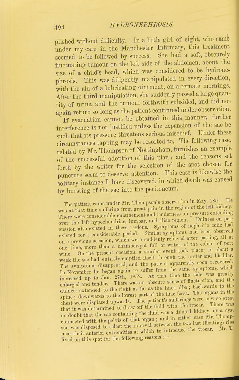 plished without difficulty. In a little girl of eight, who came under my care in the Manchester Infirmary, this treatment seemed to be followed by success. She had a soft, obscurely fluctuating tumour on the left side of the abdomen, about the size of a child's head, which was considered to be hydrone- phrosis. This was diligently manipulated in every direction, with the aid of a lubricating ointment, on alternate mornings. After the third manipulation, she suddenly passed a large quan- tity of urine, and the tumour forthwith subsided, and did not ao-ain return so long as the patient continued under observation. °If evacuation cannot be obtained in this manner, further interference is not justified unless the expansion of the sac be such that its pressure threatens serious mischief. Under these circumstances tapping may be resorted to. The following case, related by Mr. Thompson of Nottingham, furnishes an example of the successful adoption of this plan; and the reasons set forth by the writer for the selection of the spot chosen for puncture seem to deserve attention. This case is likewise the solitary instance I have discovered, in which death was caused by bursting of the sac into the peritoneum. The patient came under Mr. Thompson's observation in May 1851 He was at that time suffering from great pain in the region of the left^dney There were considerable enlargement and tenderness on pressure extending over the left hypochondriac, lumbar, and iliac regions. Dulness on per- ciision also existed in these regions. Symptoms of nephrite cohe had existed for a considerable period. Similar symptoms had been obsey ed on a previous occasion, which were suddenly relieved after passing, all at o e tml more than a chamber-pot full of water, of the colour of port wne On*e present occasion, a similar event took place; in about a Tel the sac had entirely emptied itself through the The symptoms disappeared, and the patient apparently soon r cove ed^ In November he began again to suffer from he same Wj^^g increased up to Jan. 27th, 1852. At tins time the de was greatly enlarged and tender. There wu an obscure sense of dulneu extended to the right as far as the knea alba ; backwards, to sr,ine • downwards to the lowest part of the iliac fossa. The oigans m ti e Tst wei™laced upwards. The patient's «^ that it was determined to draw off the fluid ^ *££^_T£^ no doubt that the sac containing the fluid was a Mated ^ connected with the pelvis of that organ ; andL *i either case Mr.Tlomg son was disposed to select the interval^ between near their anterior extremities at which to introduce the trocar. Mr. fixed on this spot for the following reasons