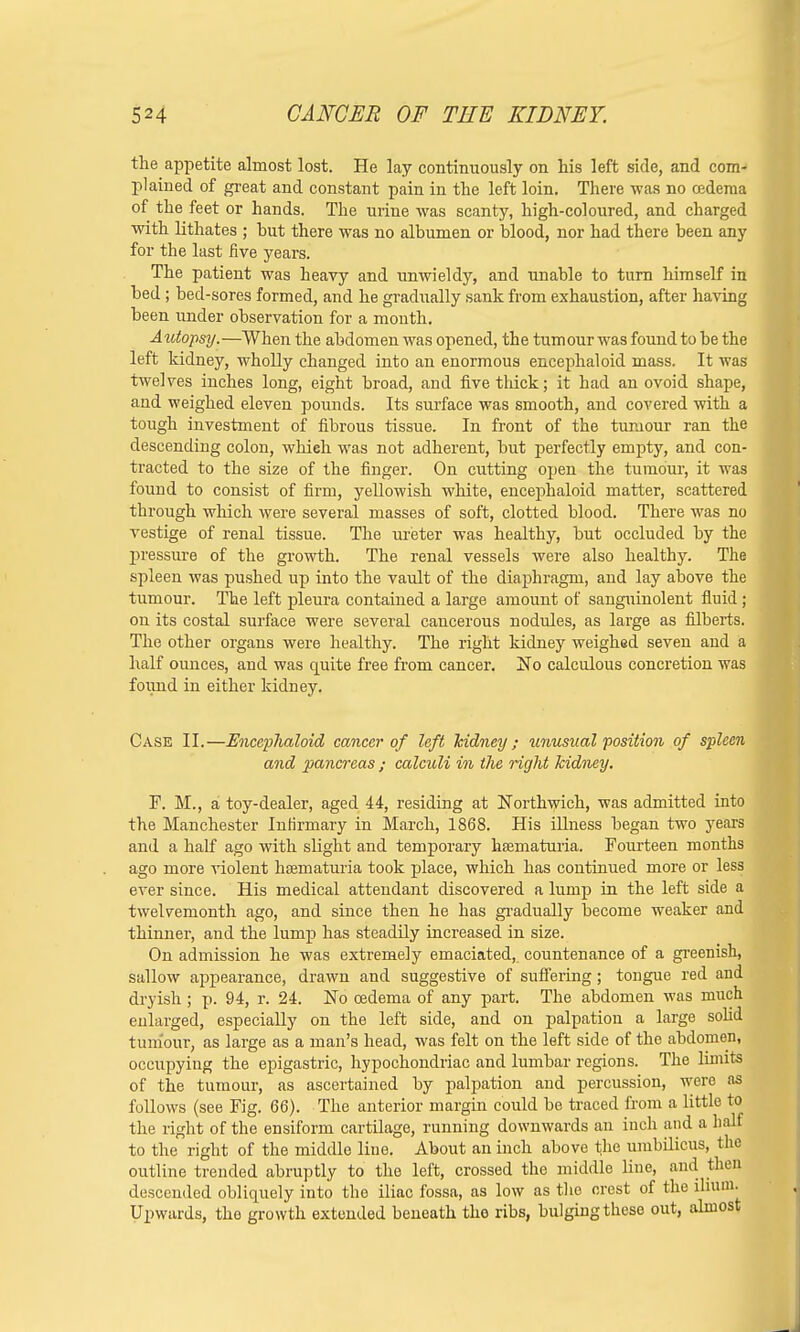 the appetite almost lost. He lay continuously on his left side, and com- plained of great and constant pain in the left loin. There was no oedema of the feet or hands. The urine was scanty, high-coloured, and charged with lithates ; hut there was no albumen or blood, nor had there been any for the last five years. The patient was heavy and unwieldy, and unable to turn himself in bed; bed-sores formed, and he gradually sank from exhaustion, after having been under observation for a month. Autopsy.—When the abdomen was opened, the turn our was found to be the left kidney, wholly changed into an enormous encephaloid mass. It was twelves inches long, eight broad, and five thick; it had an ovoid shape, and weighed eleven pounds. Its surface was smooth, and covered with a tough investment of fibrous tissue. In front of the tumour ran the descending colon, which was not adherent, but perfectly empty, and con- tracted to the size of the finger. On cutting open the tumour, it was found to consist of firm, yellowish white, encephaloid matter, scattered through which were several masses of soft, clotted blood. There was no vestige of renal tissue. The ureter was healthy, but occluded by the pressure of the growth. The renal vessels were also healthy. The spleen was pushed up into the vault of the diaphragm, and lay above the tumour. The left pleura contained a large amount of sanguinolent fluid ; on its costal surface were several cancerous nodules, as large as filberts. The other organs were healthy. The right kidney weighed seven and a half oimces, and was quite free from cancer. No calculous concretion was found in either kidney. Case II.—Encephaloid cancer of left kidney; unusual position of spleen and pancreas ; calculi in the right kidney. F. M., a toy-dealer, aged 44, residing at Northwich, was admitted into the Manchester Infirmary in March, 1868. His illness began two years and a half ago with slight and temporary hsematuria. Fourteen months ago more violent hsematuria took place, which has continued more or less ever since. His medical attendant discovered a lump in the left side a twelvemonth ago, and since then he has gradually become weaker and thinner, and the lump has steadily increased in size. On admission he was extremely emaciated, countenance of a greenish, sallow appearance, drawn and suggestive of suffering; tongue red and dryish; p. 94, r. 24. No oedema of any part. The abdomen was much enlarged, especially on the left side, and on palpation a large solid tumour, as large as a man's head, was felt on the left side of the abdomen, occupying the epigastric, hypochondriac and lumbar regions. The limits of the tumour, as ascertained by palpation and percussion, were as follows (see Fig. 66). The anterior margin could be traced from a little to the right of the ensiform cartilage, running downwards an inch and a half to the right of the middle line. About an inch above the umbilicus, ike outline trended abruptly to the left, crossed the middle line, and then descended obliquely into the iliac fossa, as low as the crest of the ilium. Upwards, the growth extended beneath the ribs, bulging these out, almost