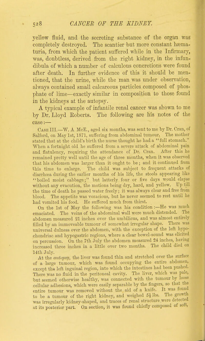 yellow fluid, and the secreting substance of the organ was completely destroyed. The scantier but more constant hema- turia, from which the patient suffered while in the Infirmary, was, doubtless, derived from the right kidney, in the infun- dibula of which a number of calculous concretions were found after death. In further evidence of this it should be men- tioned, that the urine, while the man was under observation, always contained small calcareous particles composed of phos- phate of lime—exactly similar in composition to those found in the kidneys at the autopsy. A typical example of infantile renal cancer was shown to me by Dr. Lloyd Roberts. The following are his notes of the case:— Case III.—W. A. McE., aged six months, was sent to me by Dr. Cran, of Salford, on May 1st, 1871, suffering from abdominal tumour. The mother stated that at the child's birth the nurse thought he had a full stomach. When a fortnight old he suffered from a severe attack of abdominal pain and flatulency, requiring the attendance of Dr. Cran. After this he remained pretty well until the age of three months, when it was observed that his abdomen was larger than it ought to be ; and it continued from this time to enlarge. The child was subject to frequent attacks of diarrhoea during the earlier months of his life, the stools appearing like boiled moist cabbage; but latterly four or five days woidd elapse without any evacution, the motions being dry, hard, and yellow. Up till the time of death he passed water freely; it was always clear and free from blood. The appetite was voracious, but he never seemed to rest until he had vomited his food. He suffered much from thirst. On the 1st of May the following was his condition :—He was much emaciated. The veins of the abdominal wall were much distended. The abdomen measured 21 inches over the umbilicus, and was almost entirely filled by an immoveable tumour of somewhat irregular shape. There was universal dulness over the abdomen, with the exception of the left hypo- chondriac and hypogastric regions, where a clear bowel-sound was elicited on percussion. On the 7th July the abdomen measured 24 inches, having increased three inches in a little over two months. The child died on 14th July. At the autopsy, the liver was found thin and stretched over the surface of a large tumour, which was found occupying the entire abdomen, except the left inguinal region, into which the intestines had been pushed. There was no fluid in the peritoneal cavity. The liver, which was pale, but seemed otherwise healthy, was connected with the tumour by loose cellular adhesions, which were easily separable by the fingers, so that the entire tumour was removed without the aid of a knife. It was found to be a tumour of the right kidney, and weighed 5b lbs. The growth was irregularly kidney-shaped, and traces of renal structure were detected at its posterior part. On section, it was found chiefly composed of soft,