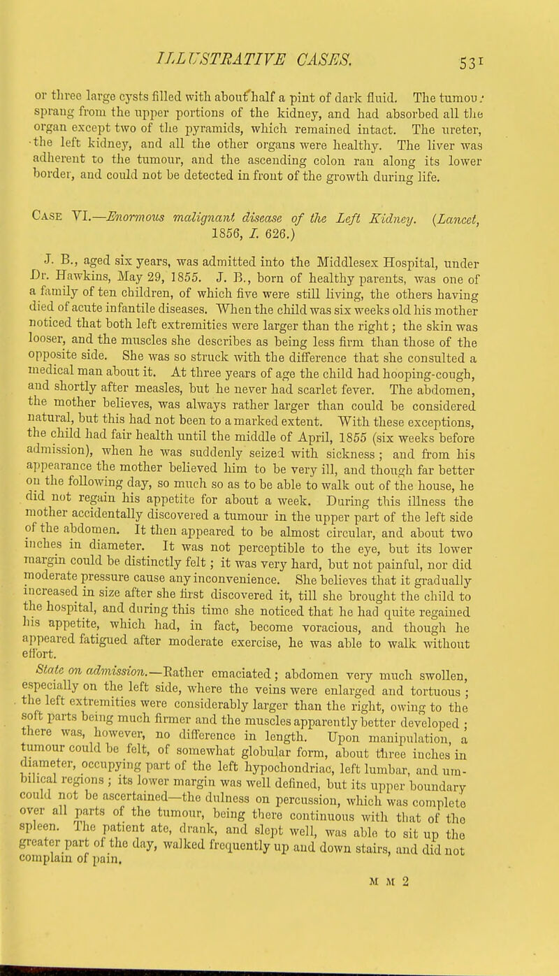or three large cysts filled with aboufhalf a pint of dark fluid. The tumou : sprang from the upper portions of the kidney, and had absorbed all the organ except two of the pyramids, which remained intact. The ureter, •the left kidney, and all the other organs were healthy. The liver was adherent to the tumour, and the ascending colon ran along its lower border, and could not be detected in front of the growth during life. Case VI.—Enormous malignant disease of the Left Kidney. (Lancet, 1856, I. 626.) J. B., aged six years, was admitted into the Middlesex Hospital, under Dr. Hawkins, May 29, 1855. J. B., born of healthy parents, was one of a family often children, of which five were still living, the others having died of acute infantile diseases. When the child was six weeks old his mother noticed that both left extremities were larger than the right; the skin was looser, and the muscles she describes as being less firm than those of the opposite side. She was so struck with the difference that she consulted a medical man about it. At three years of age the child had hooping-cough, and shortly after measles, but he never had scarlet fever. The abdomen, the mother believes, was always rather larger than could be considered natural, but this had not been to a marked extent. With these exceptions, the child had fair health until the middle of April, 1855 (six weeks before admission), when he was suddenly seized with sickness ; and from his appearance the mother believed him to be very ill, and though far better on the following day, so much so as to be able to walk out of the house, he did not regain his appetite for about a week. During this illness the mother accidentally discovered a tumour in the upper part of the left side of the abdomen. It then appeared to be almost circular, and about two inches in diameter. It was not perceptible to the eye, but its lower margin could be distinctly felt; it was very hard, but not painful, nor did moderate pressure cause any inconvenience. She believes that it gradually increased in size after she first discovered it, till she brought the child to the hospital, and during this time she noticed that he had quite regained his appetite, which had, in fact, become voracious, and though he appeared fatigued after moderate exercise, he was able to walk without effort. State on admission.—.Rather emaciated ; abdomen very much swollen, especially on the left side, where the veins were enlarged and tortuous ; the left extremities were considerably larger than the right, owing to the soft parts being much firmer and the muscles apparently better developed • there was however, no difference in length. Upon manipulation, a tumour could be felt, of somewhat globular form, about three inches in diameter, occupying part of the left hypochondriac, left lumbar, and um- bilical regions ; its lower margin was well defined, but its upper boundary could not be ascertained—the dulness on percussion, which was complete over all parts of the tumour, being there continuous with that of the spleen. Iho patient ate, drank, and slept well, was able to sit up the greater part of the day, walked frequently up and down stairs, and did not complain of pain. M M 2