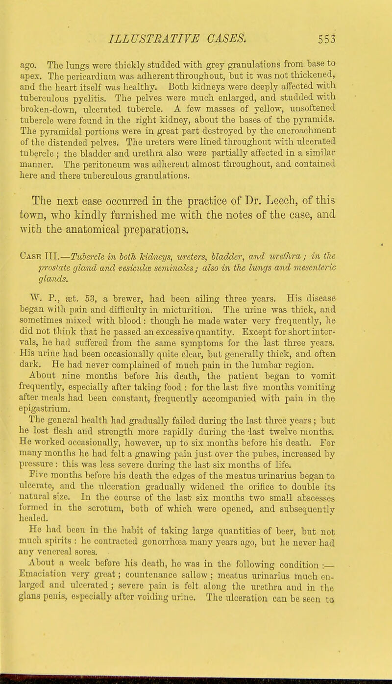 ago. The lungs were thickly studded with grey granulations from base to apex. The pericardium was adherent throughout, but it was not thickened, and the heart itself was healthy. Both kidneys were deeply affected with tuberculous pyelitis. The pelves were much enlarged, and studded with broken-down, ulcerated tubercle. A few masses of yellow, unsoftened tubercle were found in the right kidney, about the bases of the pyramids. The pyramidal portions were in great part destroyed by the encroachment of the distended pelves. The ureters were lined throughout with ulcerated tubercle ; the bladder and urethra also were partially affected in a similar manner. The peritoneum was adherent almost throughout, and contained here and there tuberculous granulations. The next case occurred in the practice of Dr. Leech, of this town, who kindly furnished me with the notes of the case, and with the anatomical preparations. Case III.—Tubercle in both kidneys, ureters, bladder, and urethra; in the prosiate gland and vesiculm seminales; also in the lungs and mesenteric glands. W. P., set. 53, a brewer, had been ailing three years. His disease began with pain and difficulty in micturition. The urine was thick, and sometimes mixed with blood: though he made water very frequently, he did not think that he passed an excessive quantity. Except for short inter- vals, he had suffered from the same symptoms for the last three years. His urine had been occasionally quite clear, but generally thick, and often dark. He had never complained of much pain in the lumbar region. About nine months before his death, the patient began to vomit frequently, especially after taking food : for the last five months vomiting after meals had been constant, frequently accompanied with pain in the epigastrium. The general health had gradually failed during the last three years; but he lost flesh and strength more rapidly during the -last twelve months. He worked occasionally, however, up to six months before his death. For many months he had felt a gnawing pain just over the pubes, increased by pressure : this was less severe during the last six months of life. Five months before his death the edges of the meatus urinarius began to ulcerate, and the ulceration gradually widened the orifice to double its natural size. In the course of the last- six months two small abscesses funned in the scrotum, both of which wero opened, and subsequently healed. He had been in the habit of taking large quantities of beer, but not much spirits : he contracted gonorrhoea many years ago, but he never had any venereal sores. • About a week before his death, ho was in the following condition : Emaciation very great; countenance sallow ; meatus urinarius much en- larged and ulcerated; severe pain is felt along the urethra and in the glaus penis, especially after voiding urine. The ulceration can be seen to