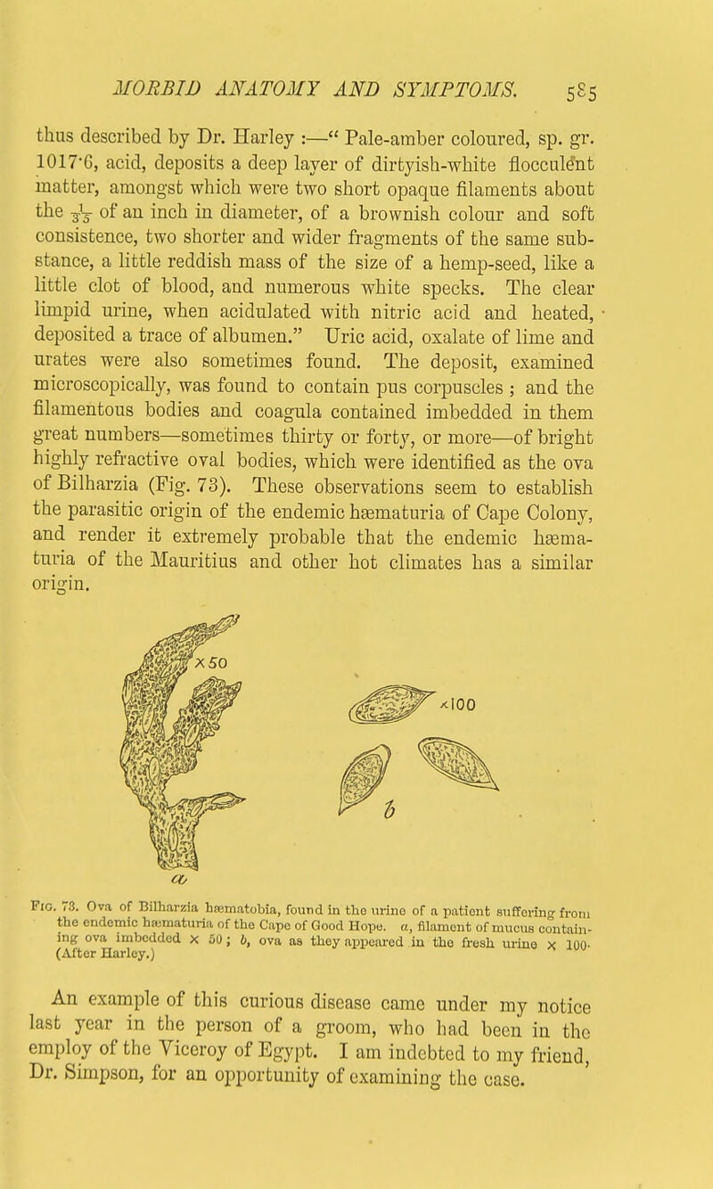 thus described by Dr. Harley :— Pale-amber coloured, sp. gr. 1017-6, acid, deposits a deep layer of dirtyish-white flocculeht matter, amongst which were two short opaque filaments about the gJj of an inch in diameter, of a brownish colour and soft consistence, two shorter and wider fragments of the same sub- stance, a little reddish mass of the size of a hemp-seed, like a little clot of blood, and numerous white specks. The clear limpid urine, when acidulated with nitric acid and heated, deposited a trace of albumen. Uric acid, oxalate of lime and urates were also sometimes found. The deposit, examined microscopically, was found to contain pus corpuscles ; and the filamentous bodies and coagula contained imbedded in them great numbers—sometimes thirty or forty, or more—of bright highly refractive oval bodies, which were identified as the ova of Bilharzia (Fig. 73). These observations seem to establish the parasitic origin of the endemic heematuria of Cape Colony, and render it extremely probable that the endemic hsema- turia of the Mauritius and other hot climates has a similar origin. Fio. 73. Ova of Bilharzia hsematobia, found in the urino of a patient suffering from the endemic hajmaturia of the Capo of Good Hope, a, filament of mucus contain- ing ova imbedded X 50; 6, ova as they appeared in tho fresh urine x 100- (After Harley.) An example of this curious disease came under my notice last year in the person of a groom, who had been in the employ of the Viceroy of Egypt. I am indebted to my friend, Dr. Simpson, for an opportunity of examining the case.